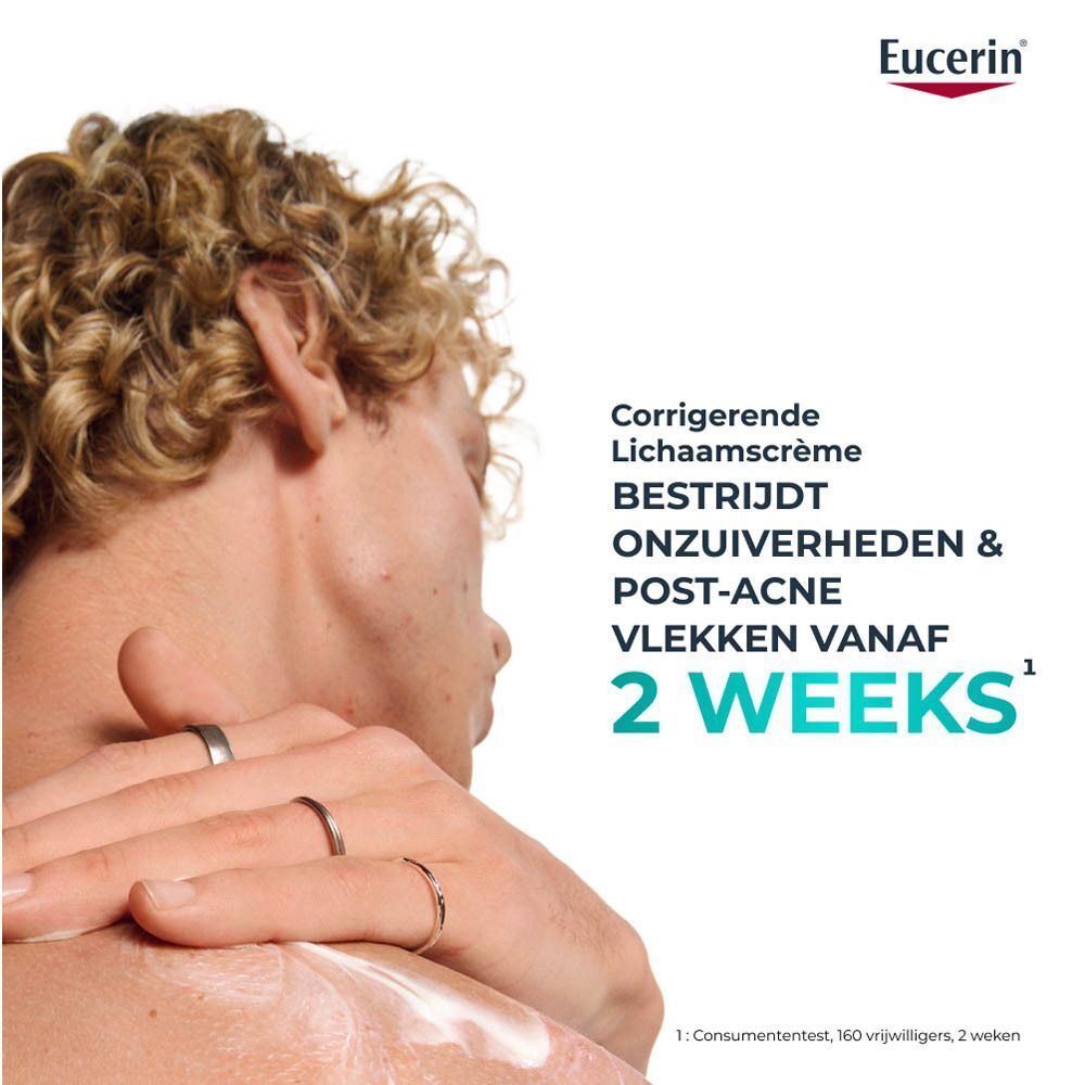 Man met crème op rug. Tekst: Corrigerende Lichaamscreme, bestrijdt onzuiverheden & post-acne vlekken vanaf 2 weeks.