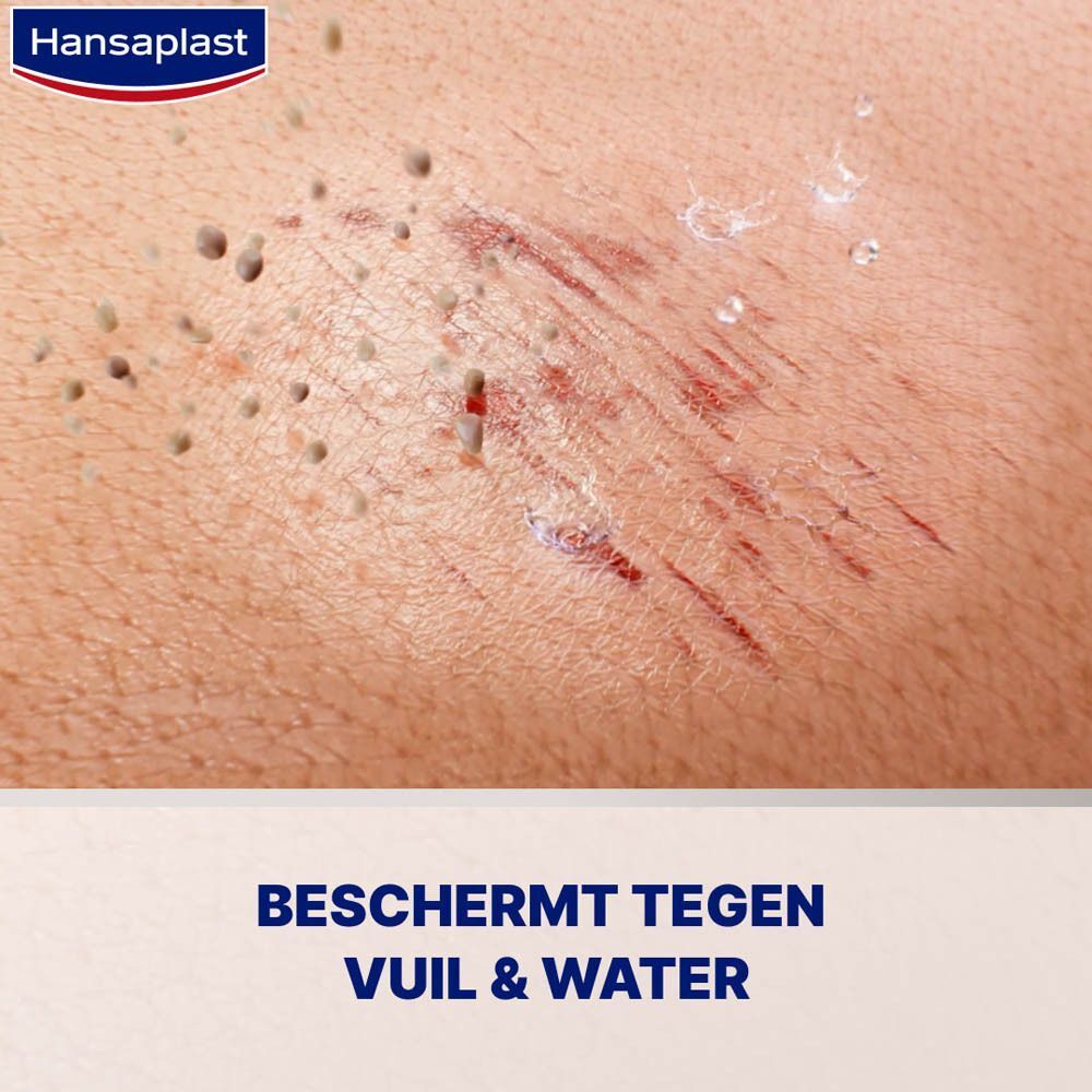 Close-up van huid met krassen, bespoten met Hansaplast Spray Pleister. Beschermt tegen vuil en water.