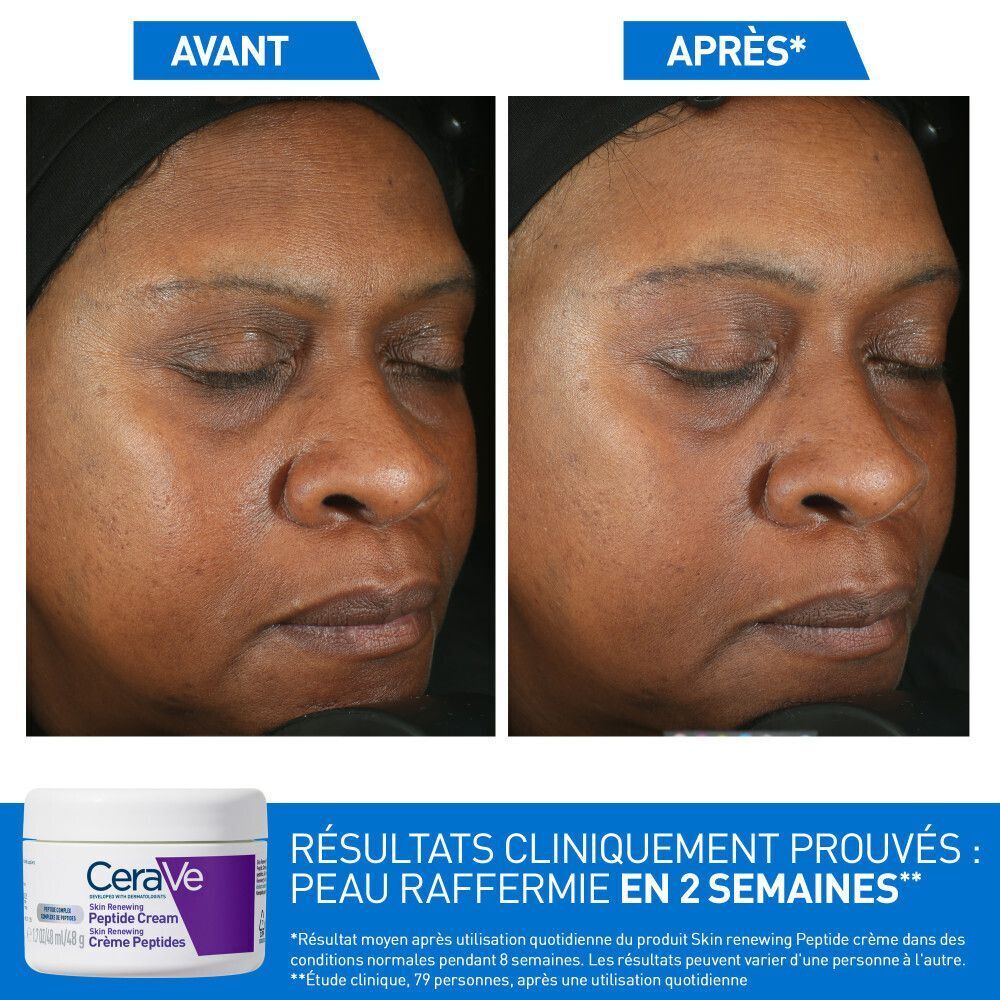 Comparaison avant-après d'un visage. En bas: CeraVe Skin Renewing Peptide Cream. Texte: Peau raffermie en 2 semaines.