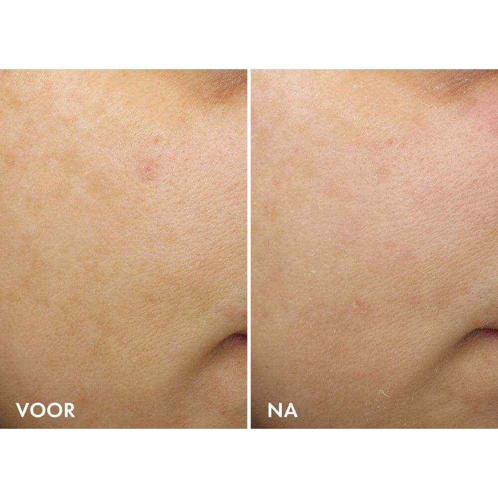 Gebruiksaanwijzing voor de nachtcrème. Week 1: 2x per week. Week 2: 's avonds. Week 3: Elke avond.