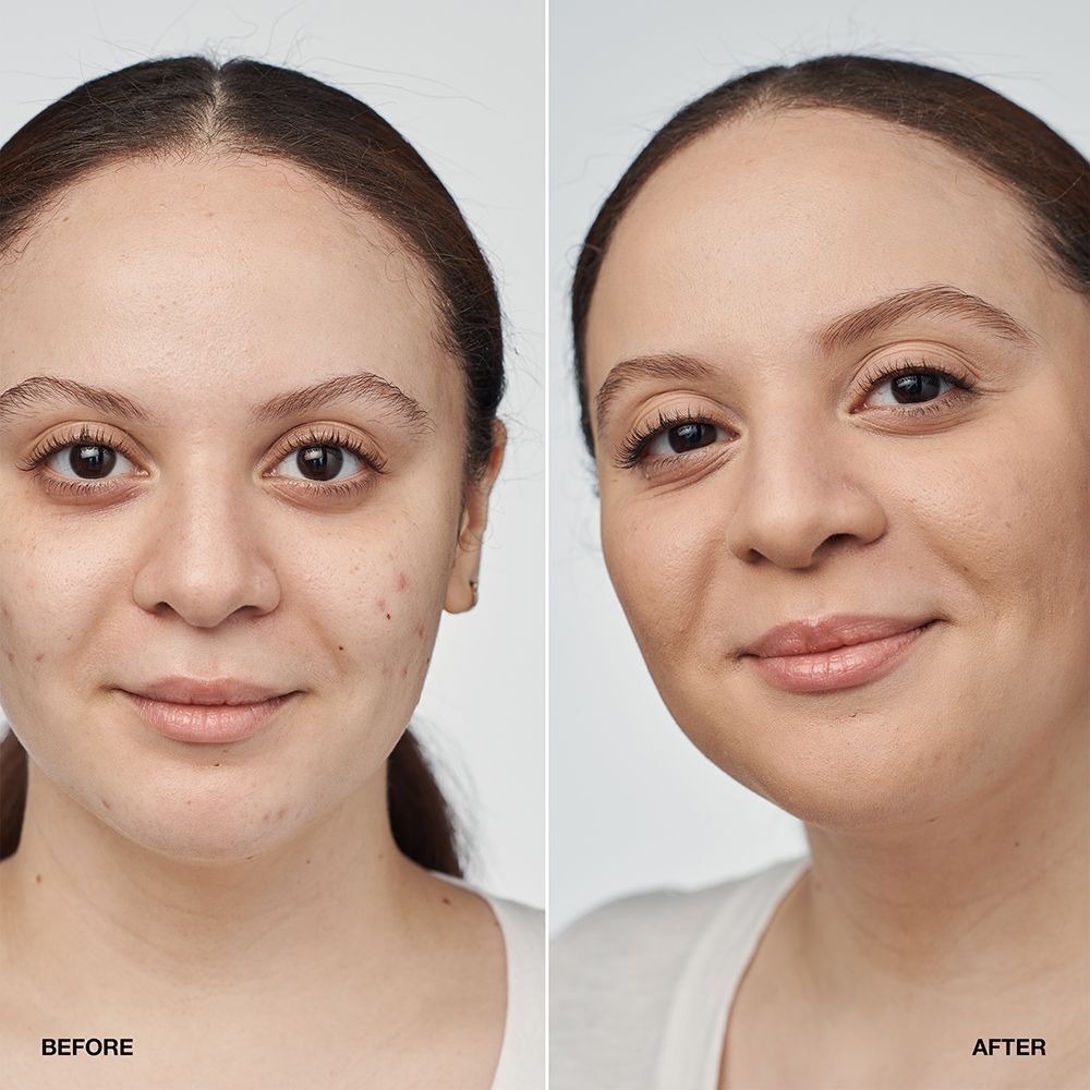 Voor-en-na vergelijking van een vrouw die Clinique Even Better Clinical Serum Foundation SPF 20 draagt.