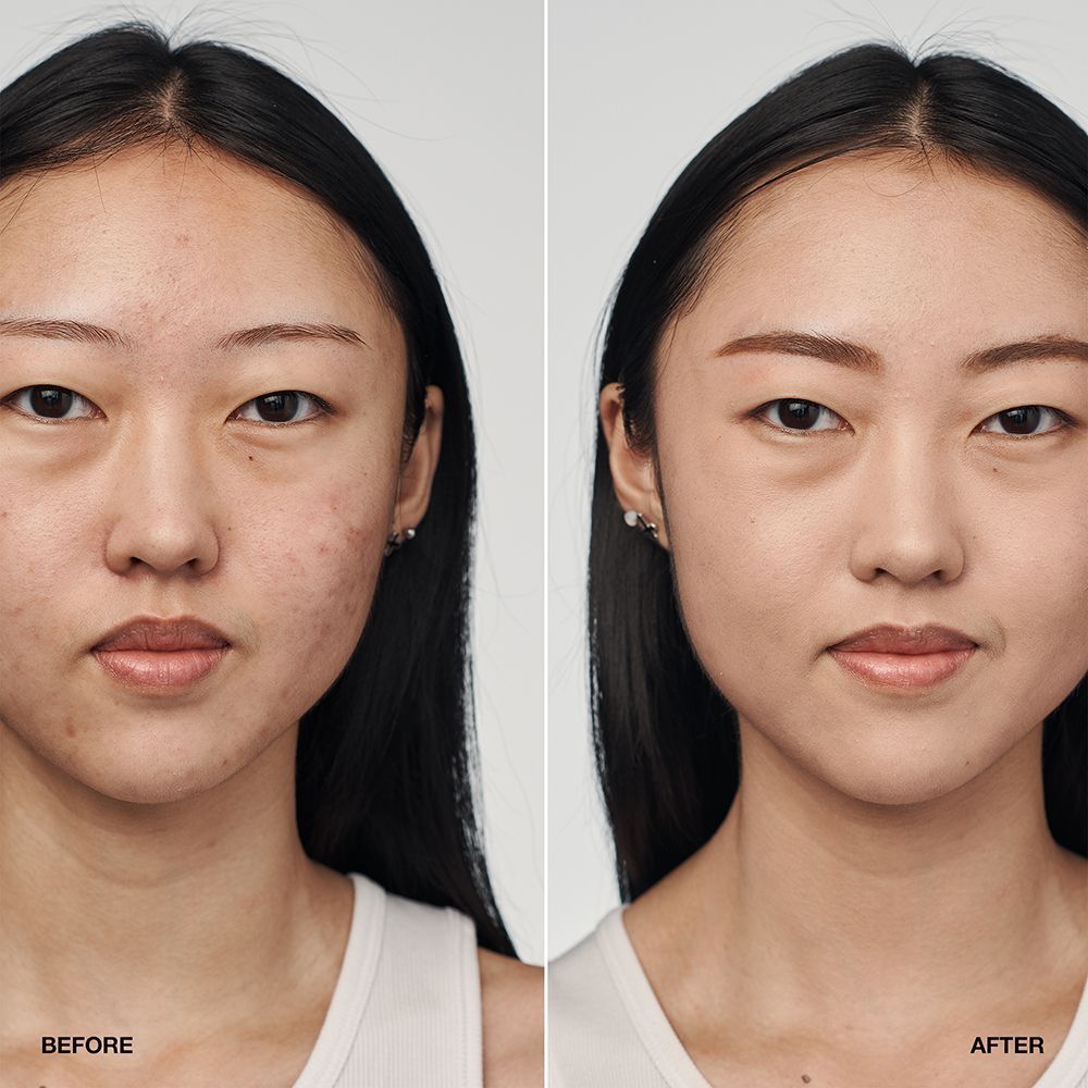 Voor-en-na vergelijking van een vrouw die CLINIQUE Even Better Clinical Serum Foundation SPF 20 draagt.