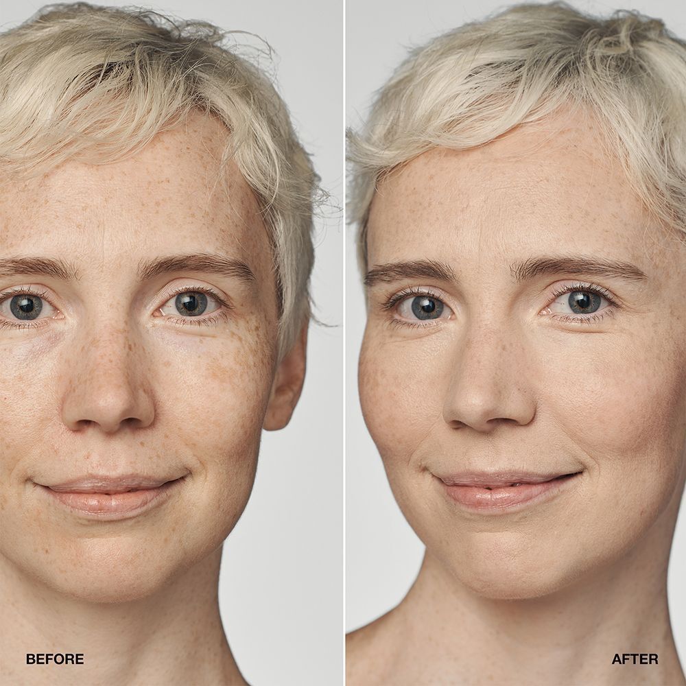 Voor-en-na vergelijking van een vrouw met CLINIQUE Even Better Clinical Serum Foundation SPF 20.