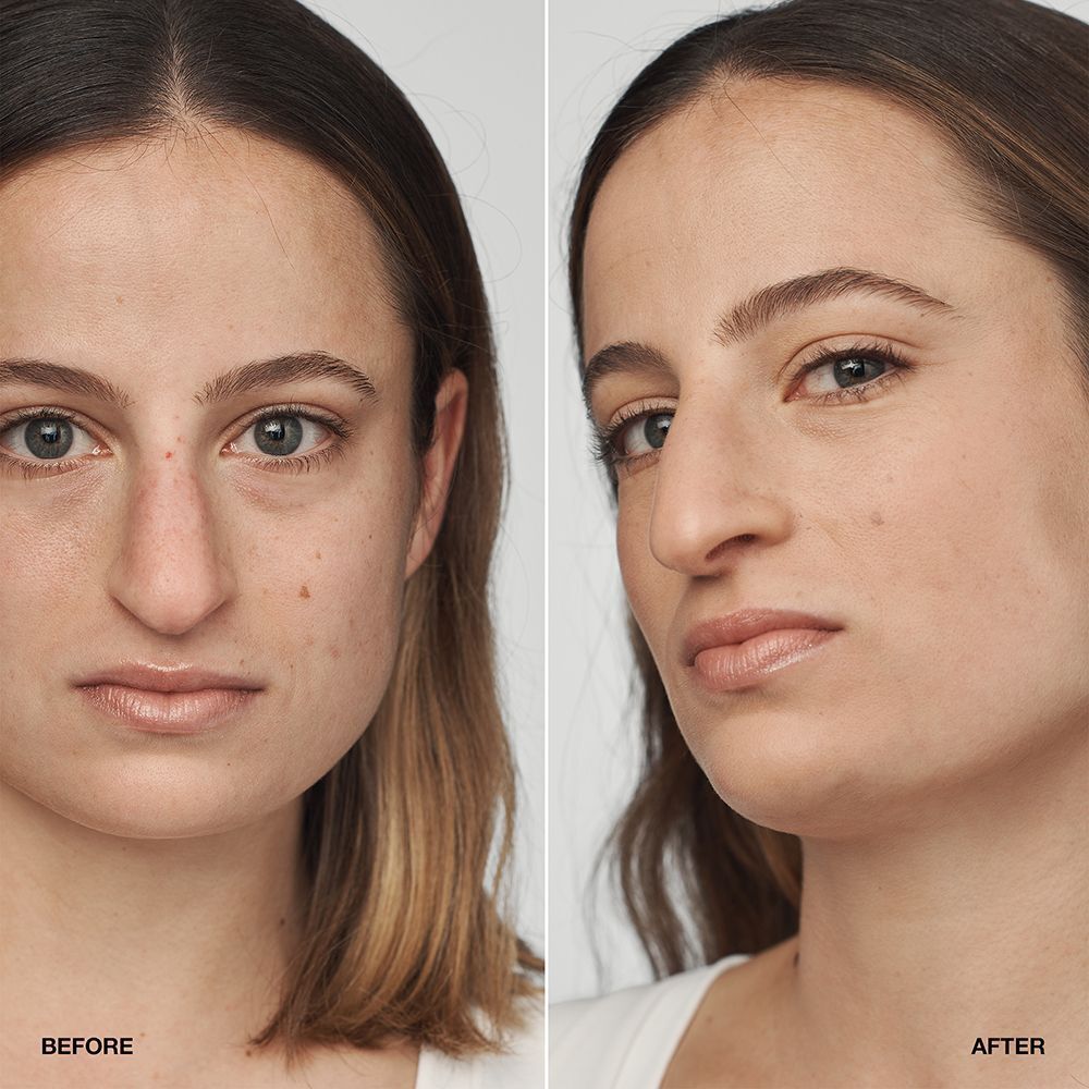 Voor-en-na vergelijking van een vrouw die CLINIQUE Even Better Clinical Serum Foundation draagt.