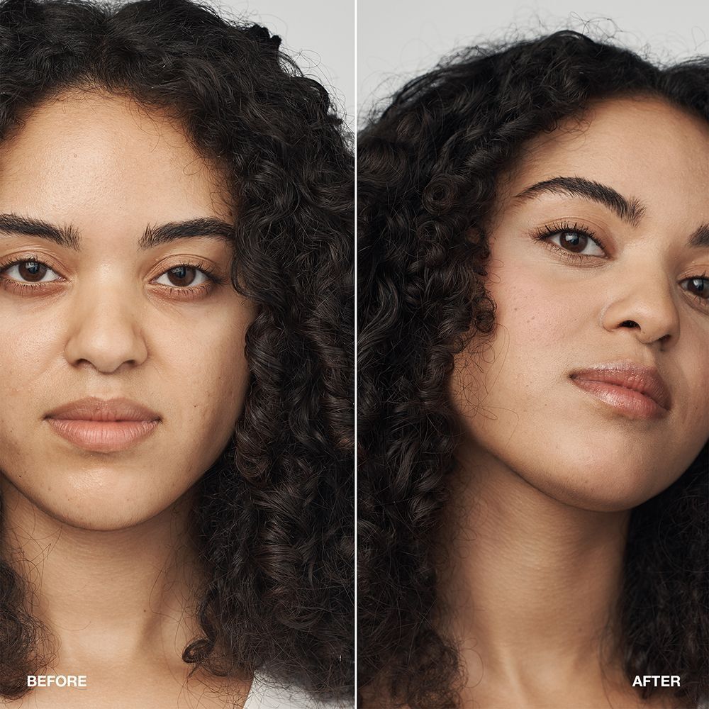 Voor/na vergelijking van een vrouw met CLINIQUE Even Better Clinical Serum Foundation SPF 20.