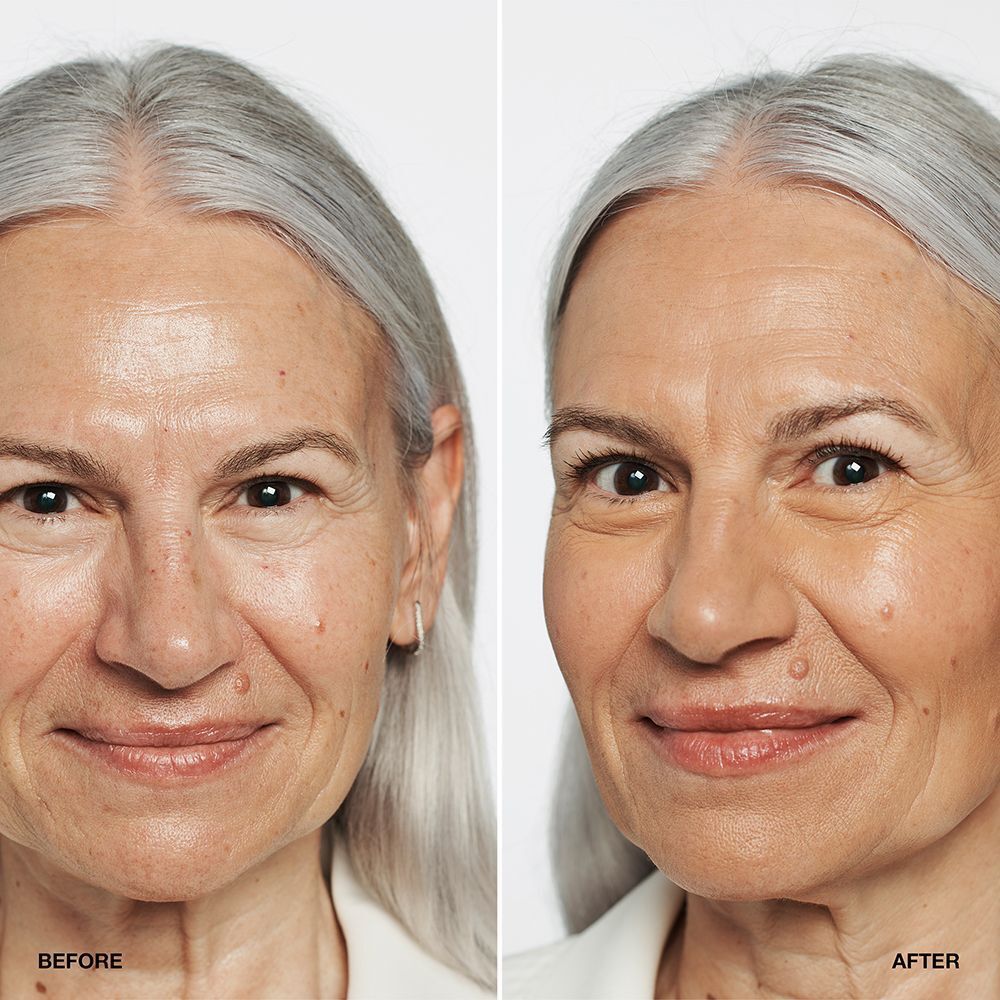 Comparaison avant/après d'une femme avec le fond de teint CLINIQUE Even Better SPF 15.