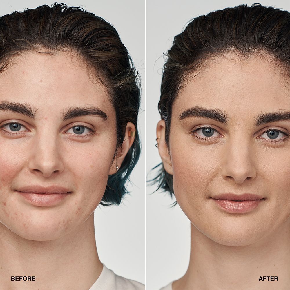 Voor-en-na vergelijking van een vrouw die CLINIQUE Even Better Clinical Serum Foundation draagt.