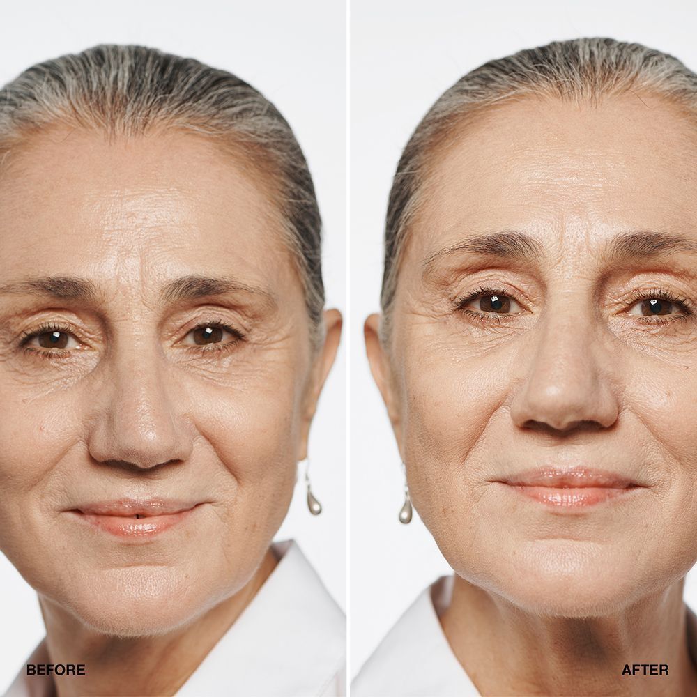 Comparaison avant/après d'une femme utilisant le fond de teint CLINIQUE Even Better SPF 15.
