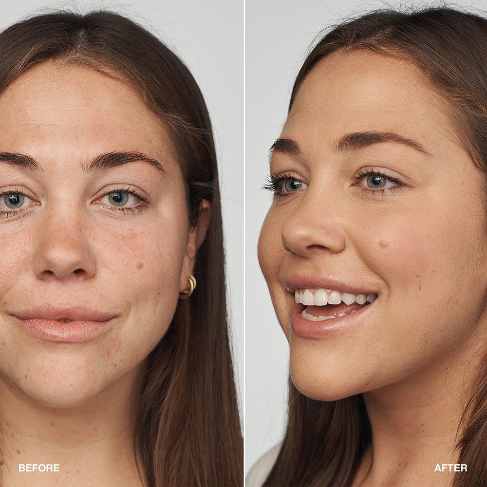 Voor/na vergelijking van een vrouw met Clinique Even Better Clinical Serum Foundation.