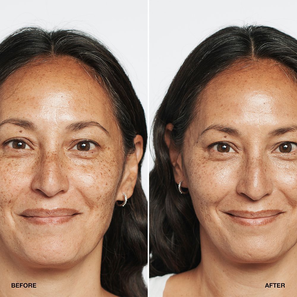 Comparaison avant/après d'une femme utilisant le fond de teint CLINIQUE Even Better SPF 15.