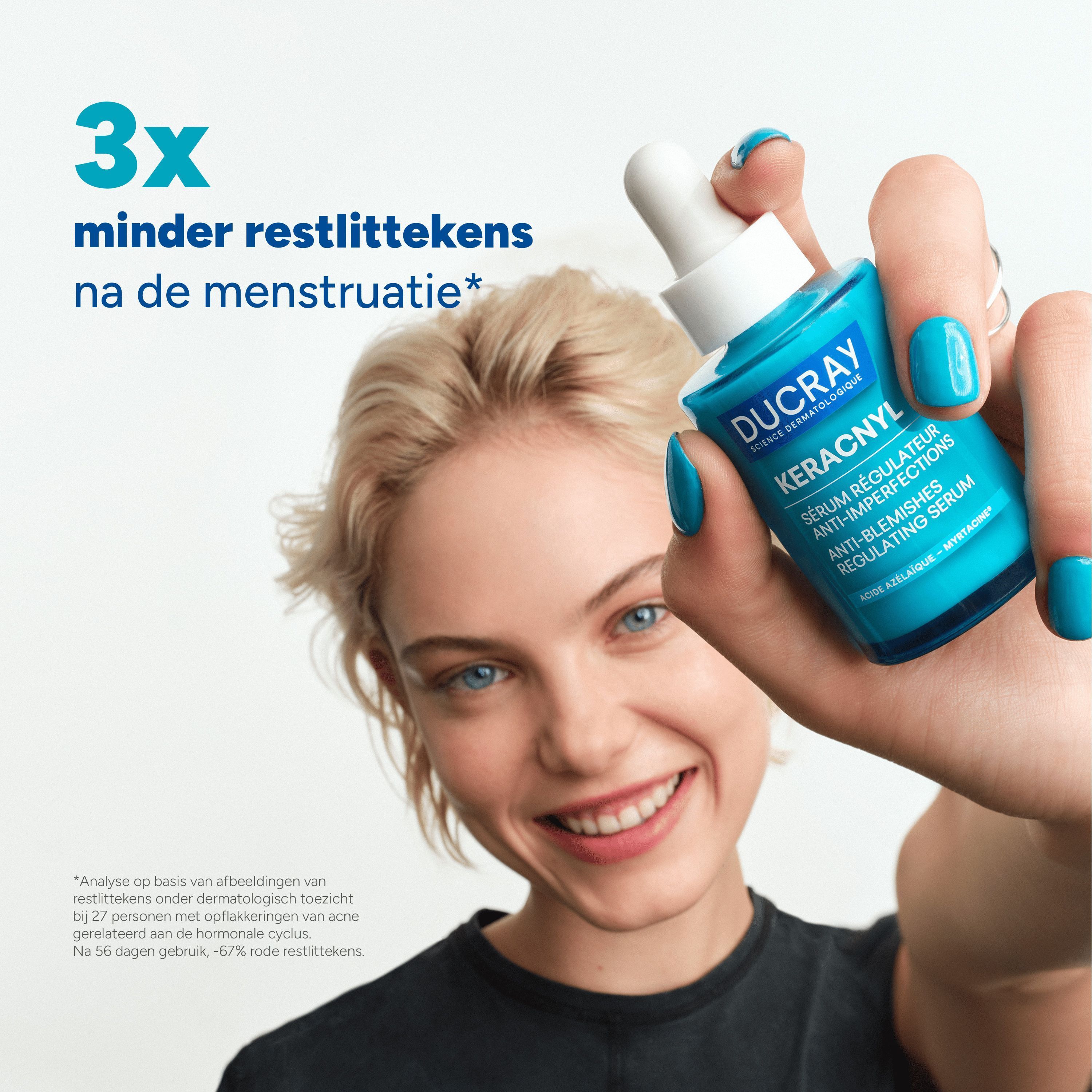Vrouw houdt een Ducray Keracnyl serumfles vast. Tekst: 3x minder restlittekens na de menstruatie.