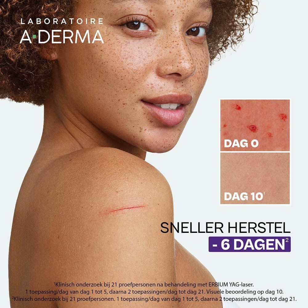 Vrouw met huidirritaties. Vergelijkingsfoto's: Dag 0 en Dag 10. Tekst: Sneller herstel - 6 dagen.