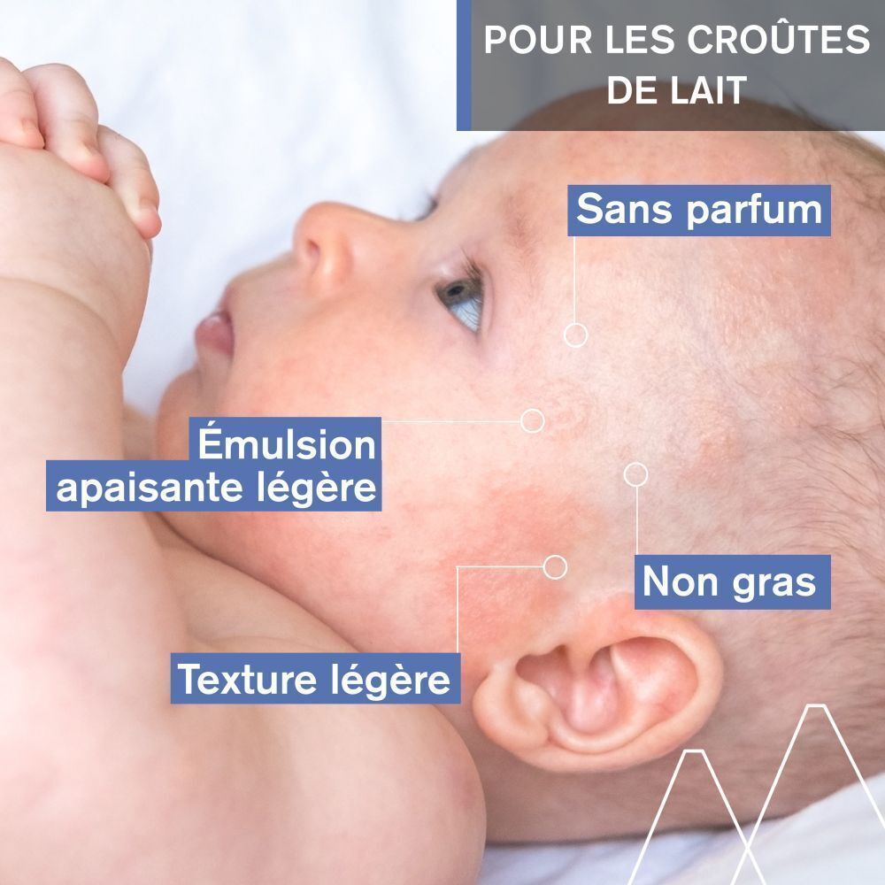 Visage de bébé avec texte : Sans parfum, Émulsion apaisante légère, Texture légère, Non gras. Texte en encadré bleu : Pour les croûtes de lait.