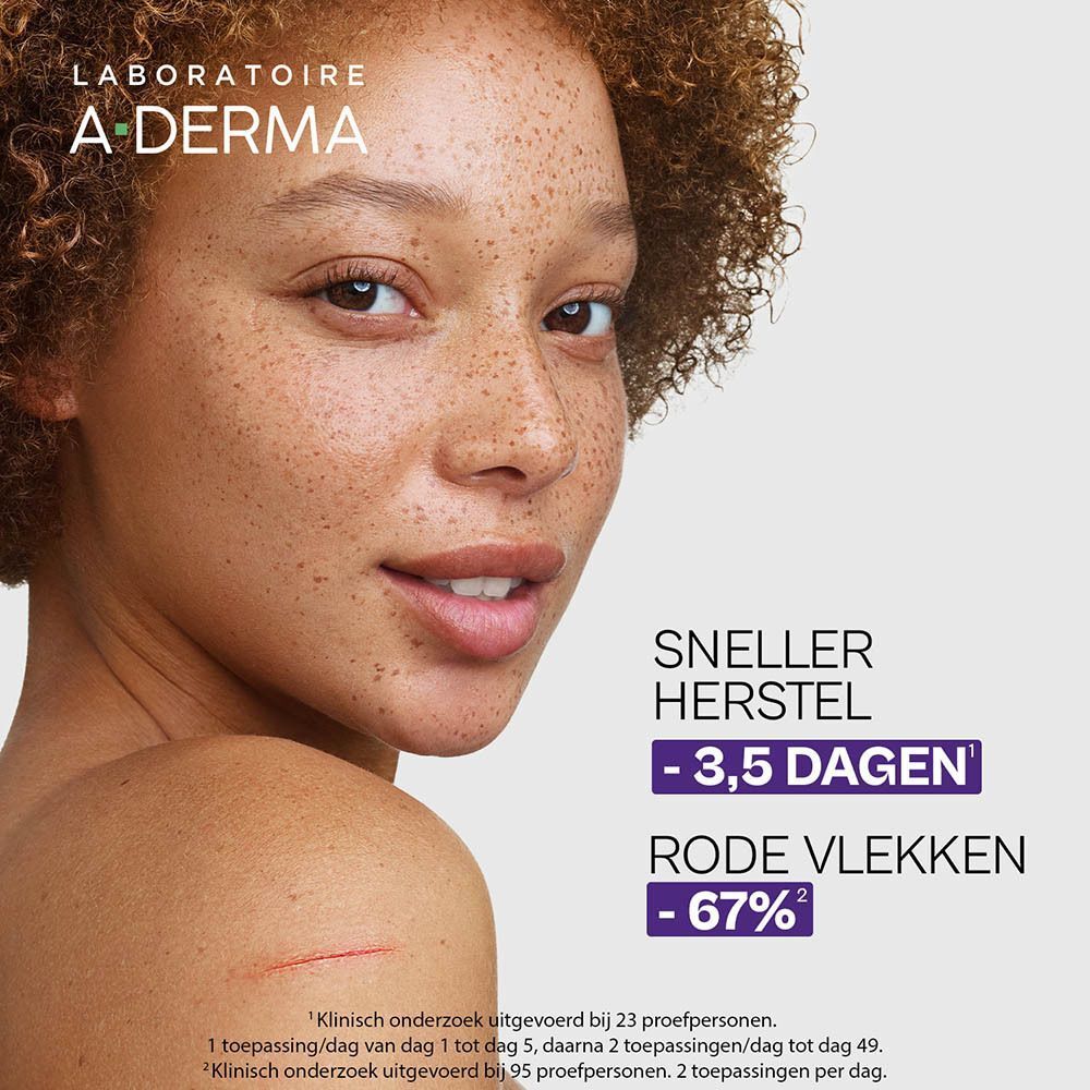 Vrouw met huidonvolkomenheden. Tekst: Snellere herstel -3,5 dagen, rode vlekken -67%.
