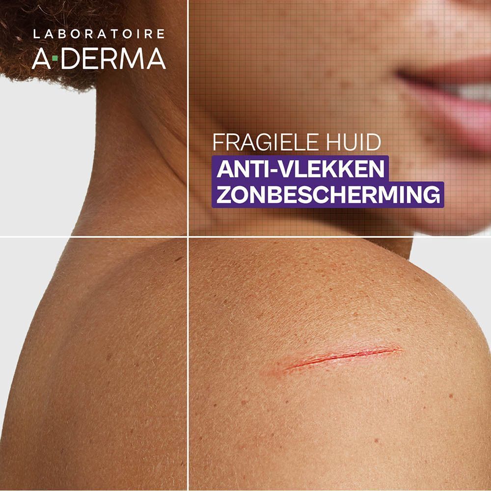 Huid met litteken. Tekst: Fragiele huid, anti-vlekken, zonbescherming.