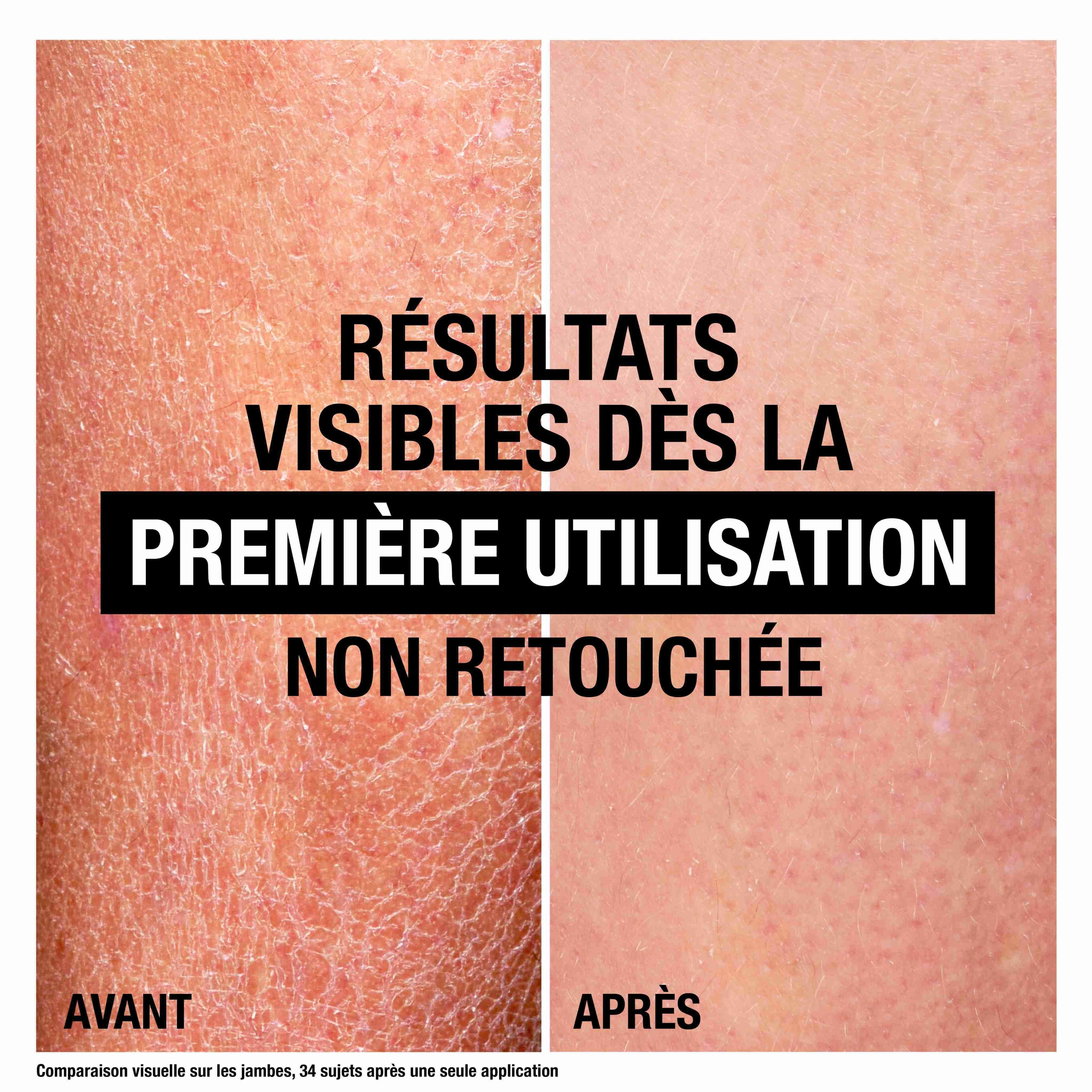 Comparaison avant/après. Peau sèche avant, peau lisse après. Texte : Résultats visibles dès la première utilisation.