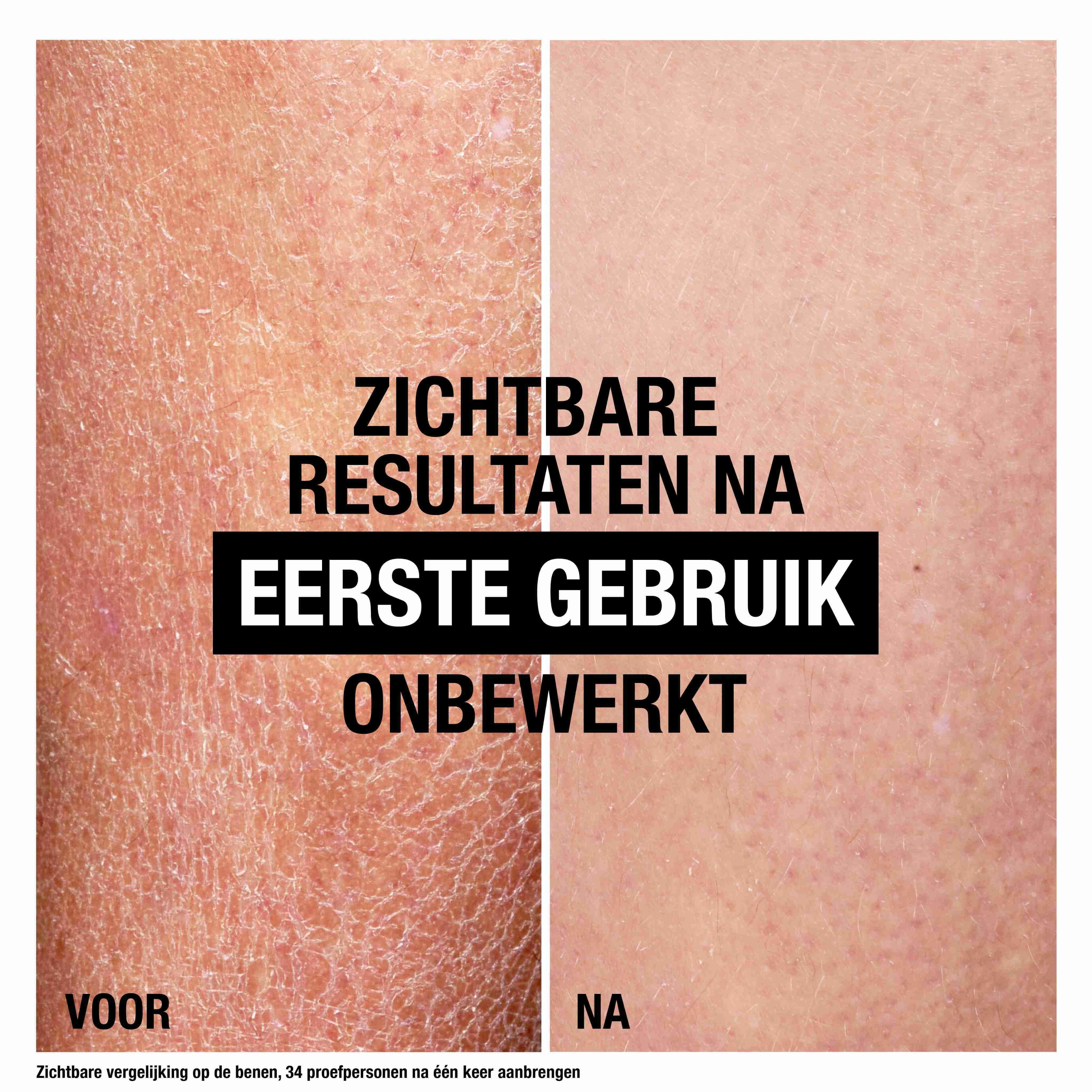 Vergelijking voor/na. Droge huid voor, gladde huid erna. Tekst: Zichtbare resultaten na eerste gebruik.
