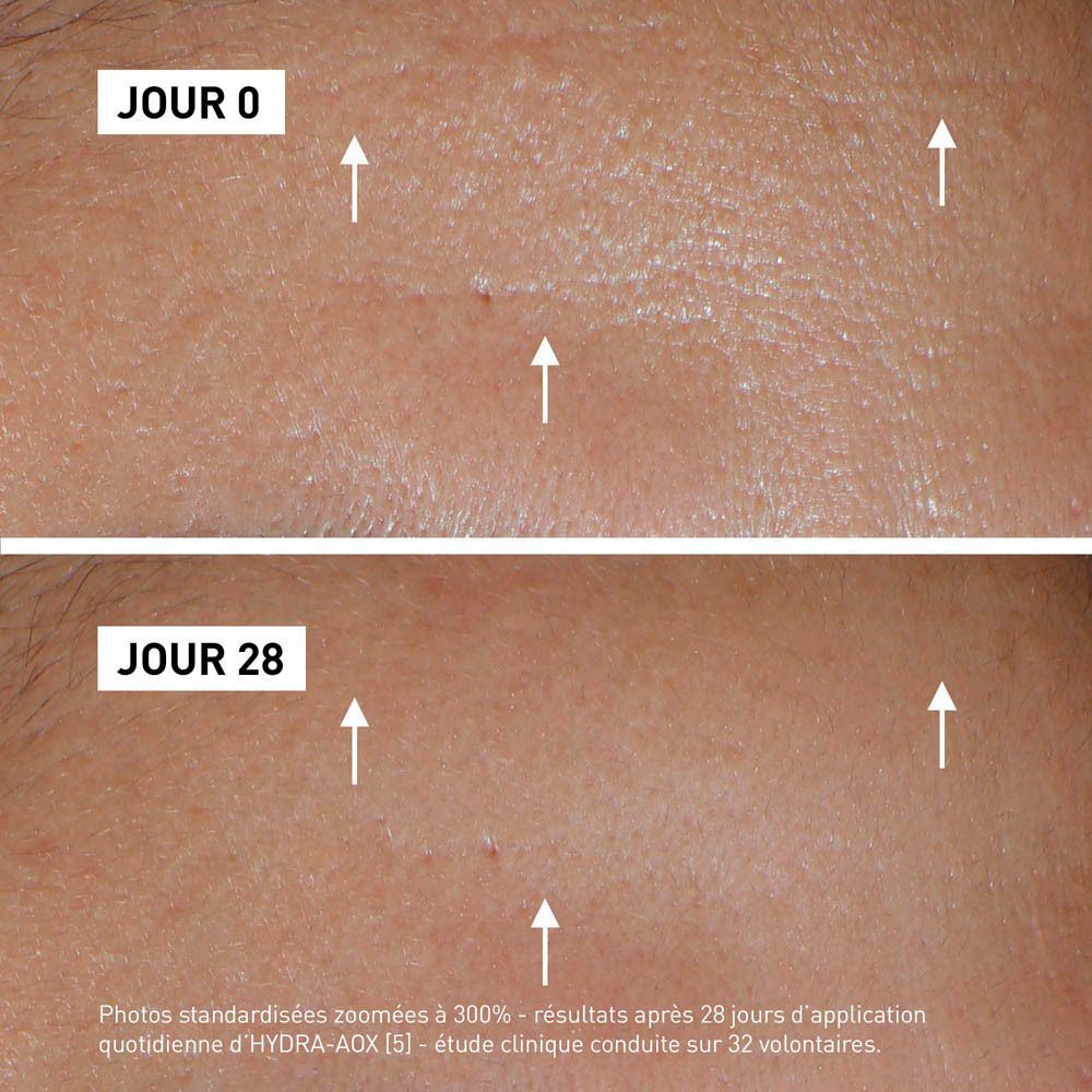 Comparaison de la peau avant et après 28 jours. Des flèches indiquent des zones. Texte: JOUR 0, JOUR 28.