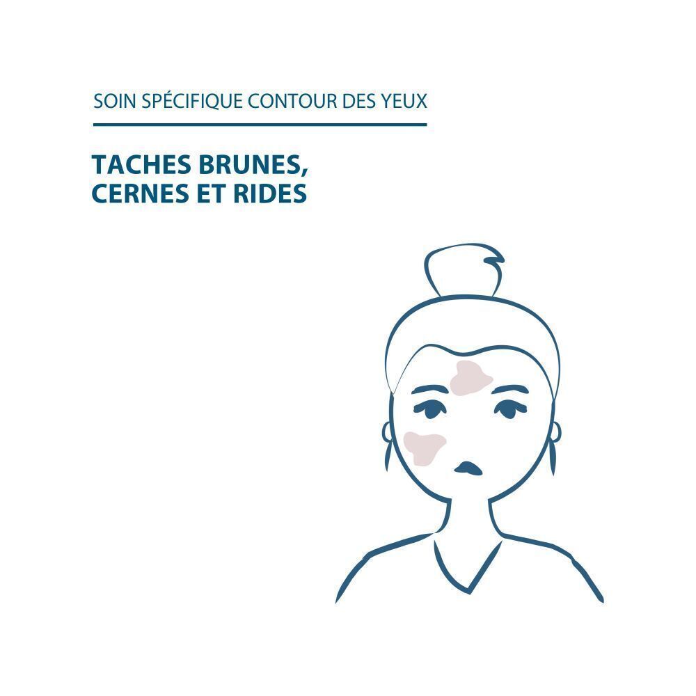 Illustration d'un visage avec imperfections. Texte: Soin spécifique contour des yeux.