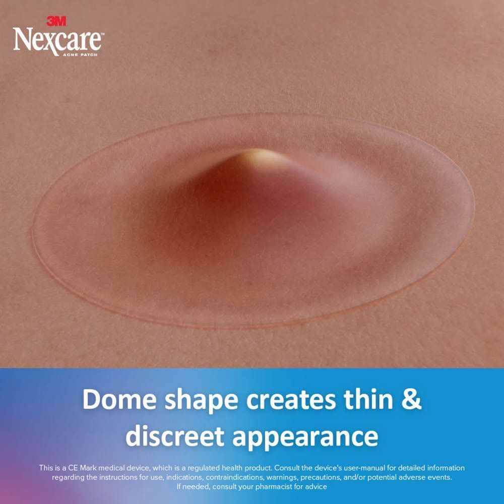 Close-up van een acne pleister op de huid. Koepelvorm. Tekst: Dunne en discrete uitstraling.