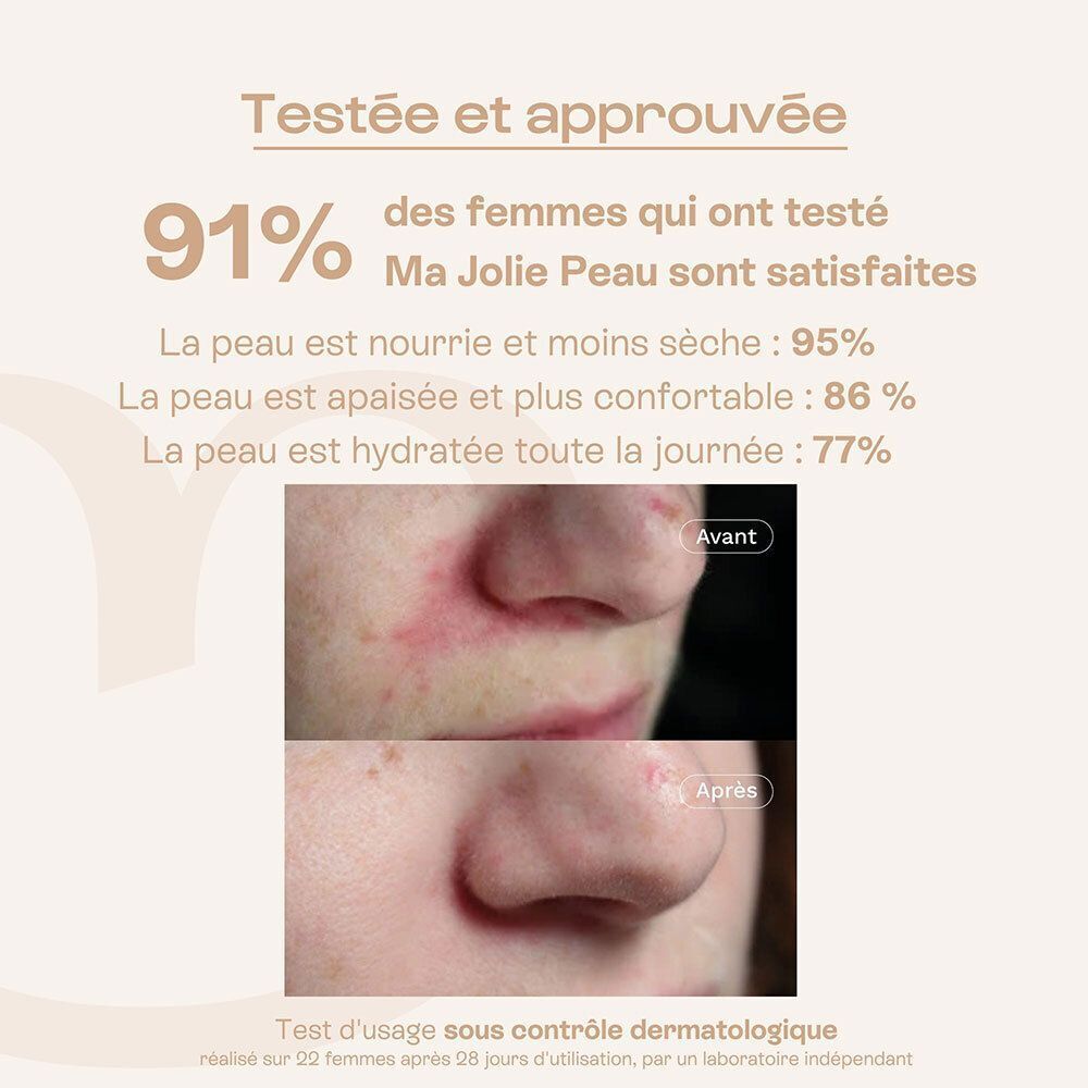 Photos avant/après montrant l'amélioration de la peau avec la crème Omum Ma Jolie Peau.