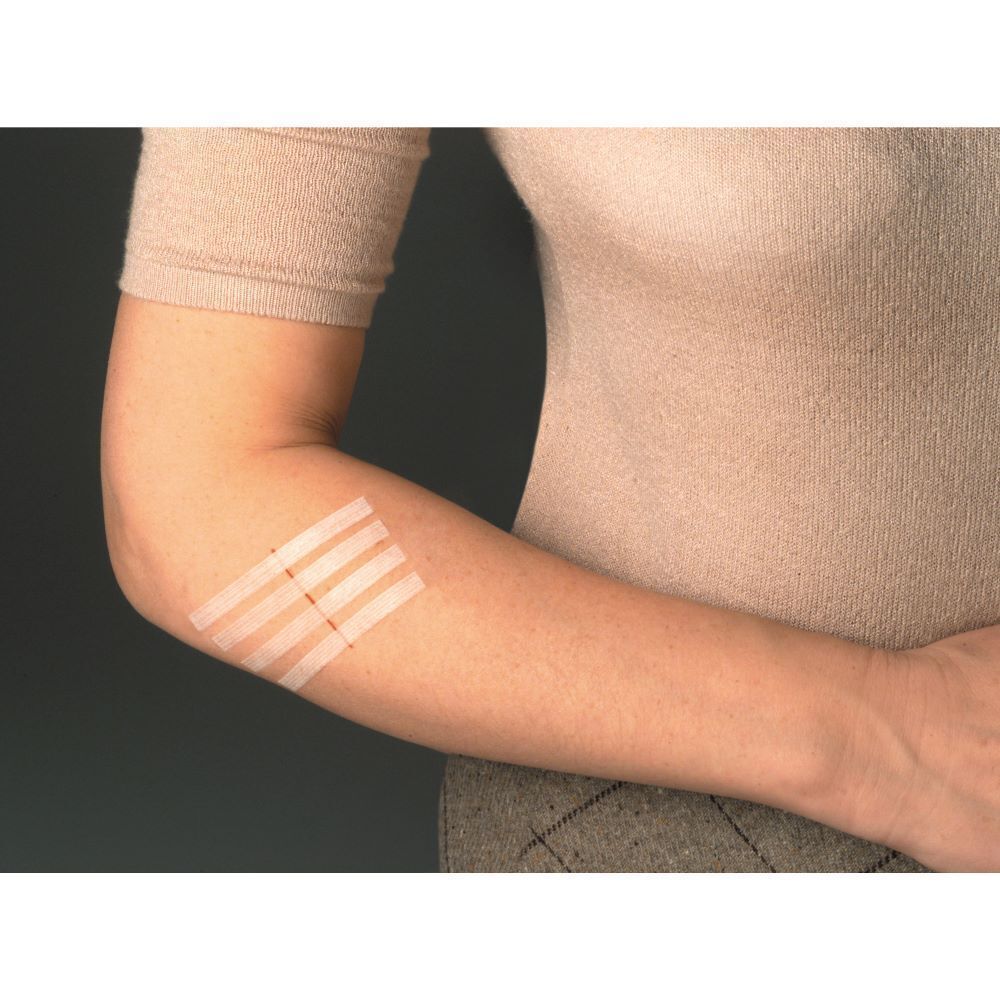 Quatre sutures cutanées Steri-Strip Nexcare sur un avant-bras.