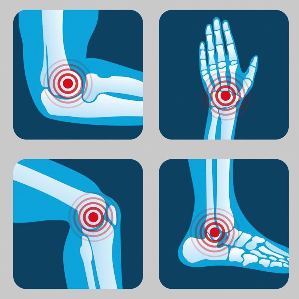 Illustrations d'articulations (coude, main, genou, cheville) avec des points de douleur rouges.