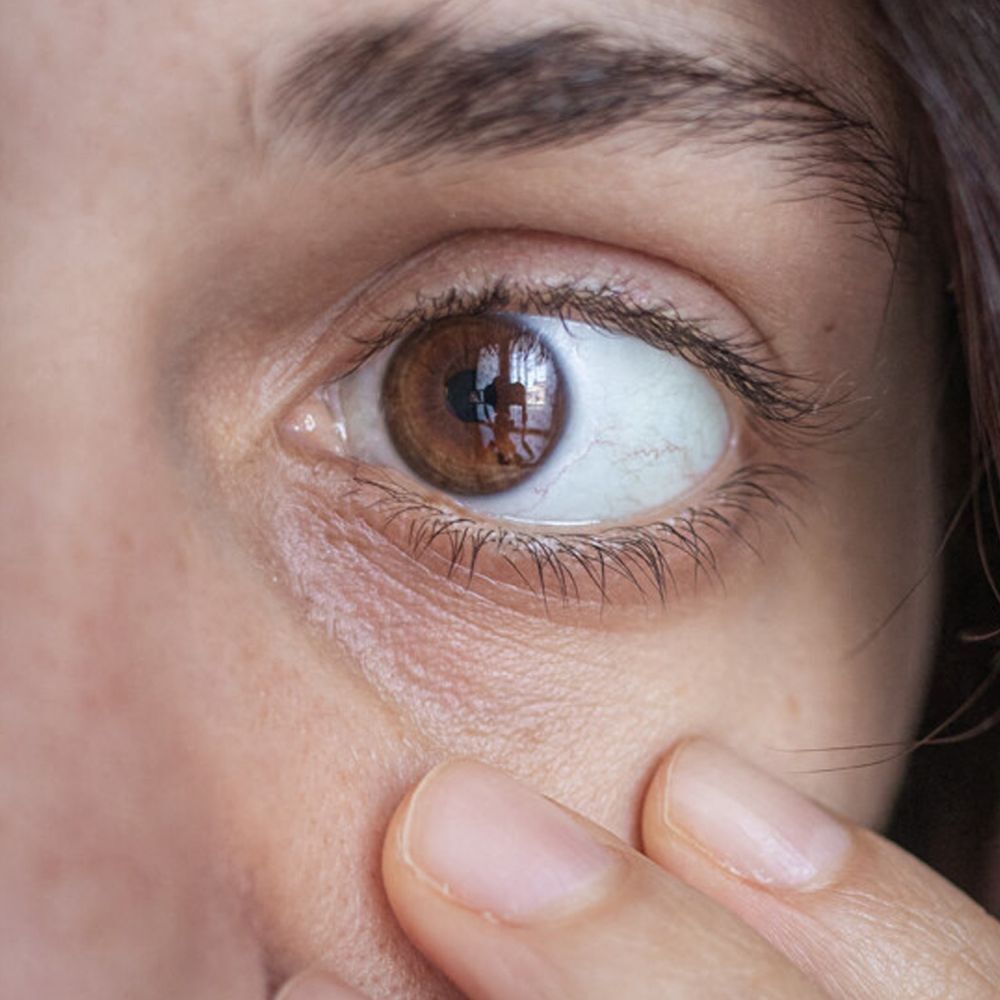 Close-up van een vermoeid oog met fijne lijntjes onder het oog.