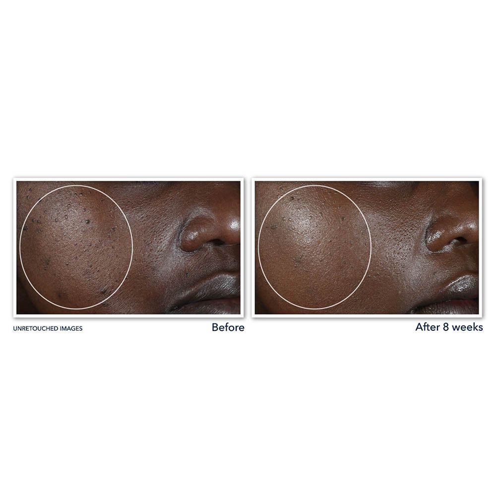 Roc Multi Correxion Even Tone+Lift Nachtcrème