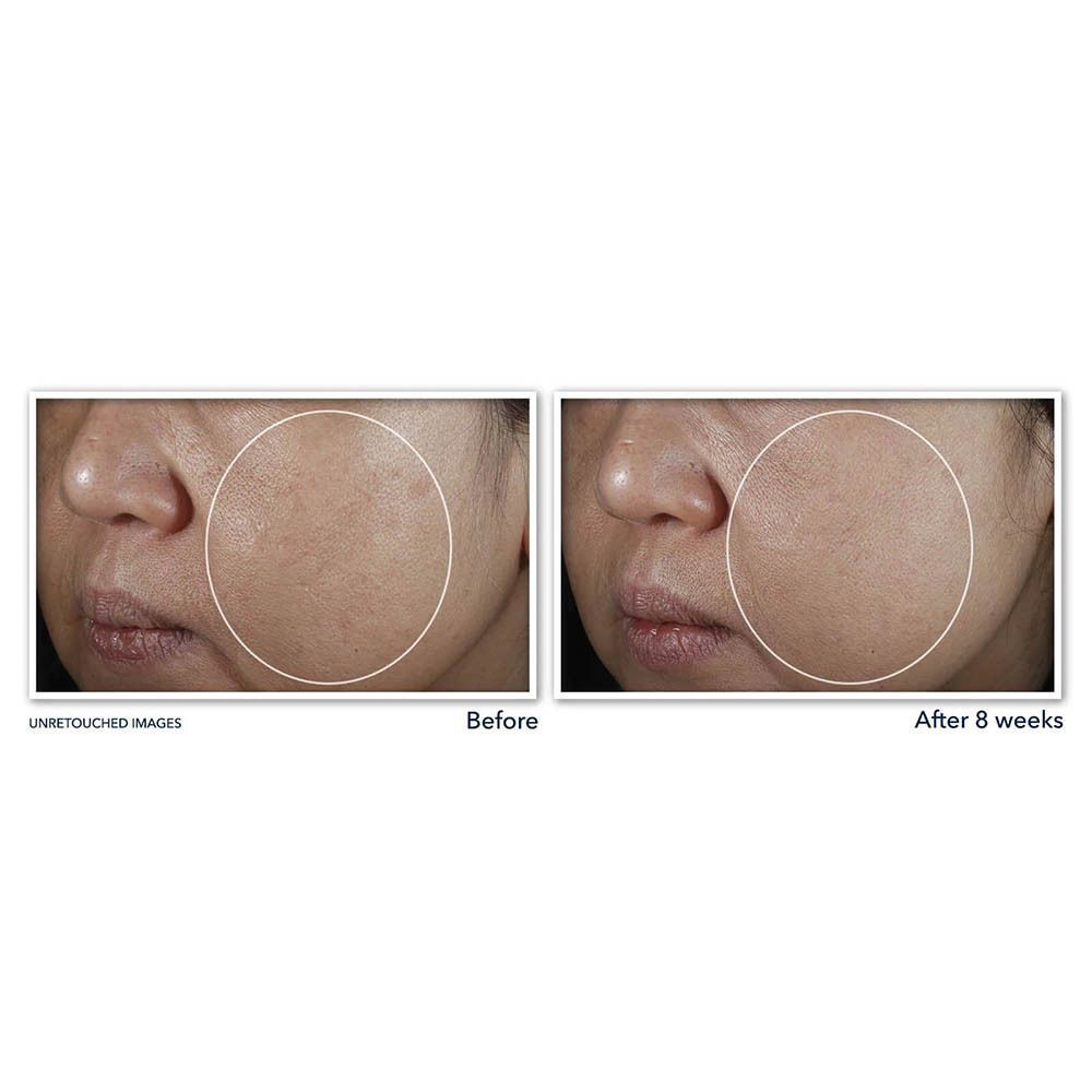 Roc Multi Correxion Even Tone+lift Crème Nuit