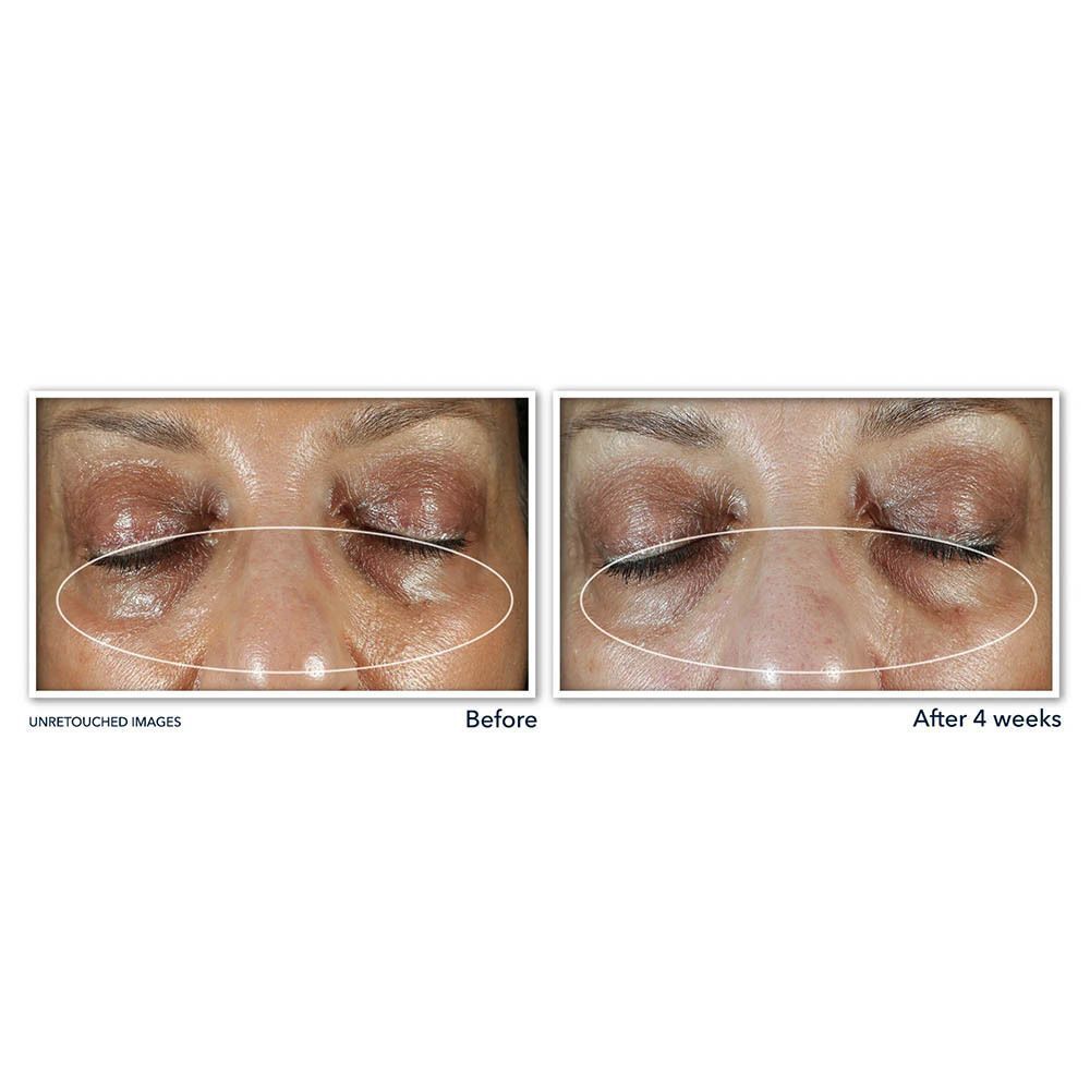 RoC Multi Correxion Even Tone + Lift Crème Contour des Yeux