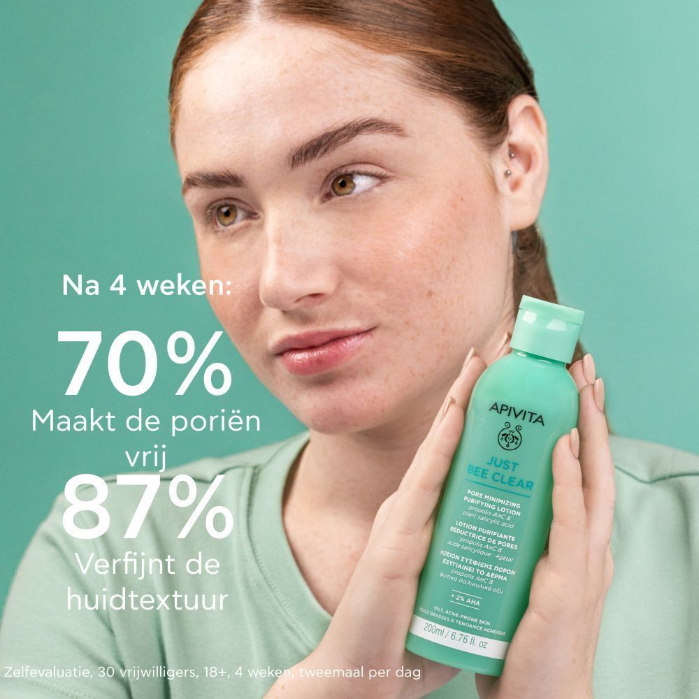 Vrouw vasthoudend een Apivita Just Bee Clear lotion. Tekst: 'Na 4 weken: 70% poriën vrij', '87% verfijnde huidtextuur'.