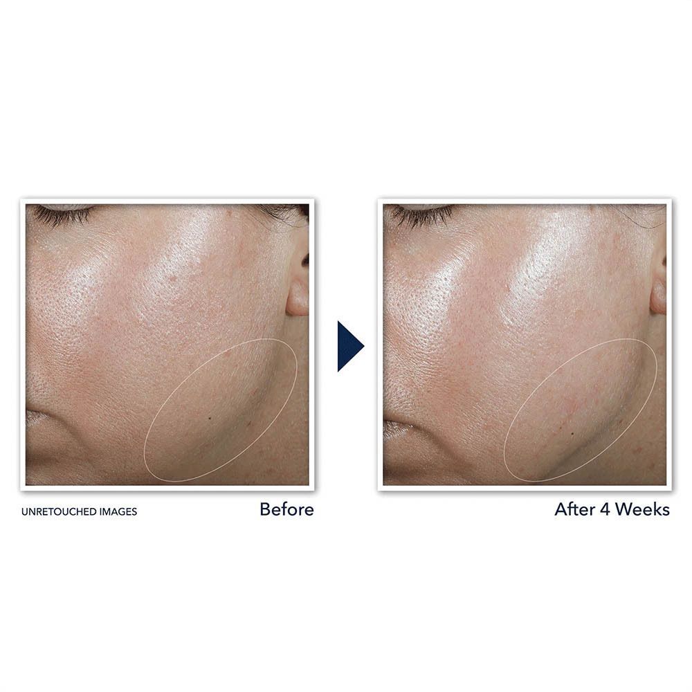 RoC Derm Correxion Contourcrème