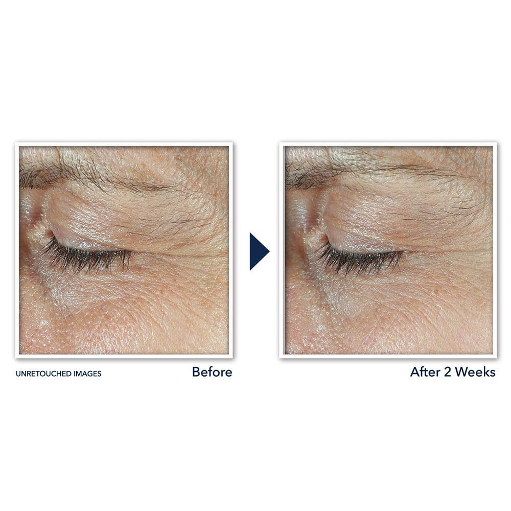 RoC Derm Correxion Soin Duo Contour des Yeux