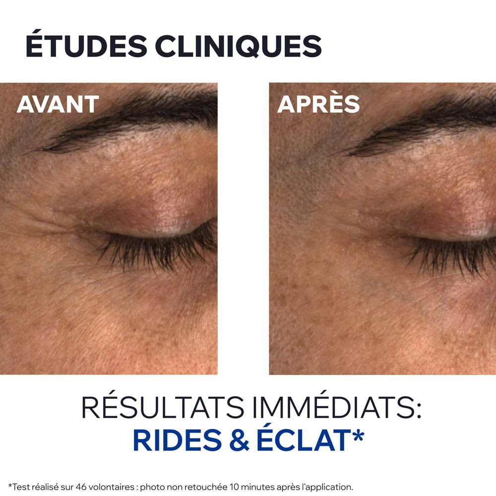 Comparaison avant/après du contour des yeux après application Uriage Age Absolu.