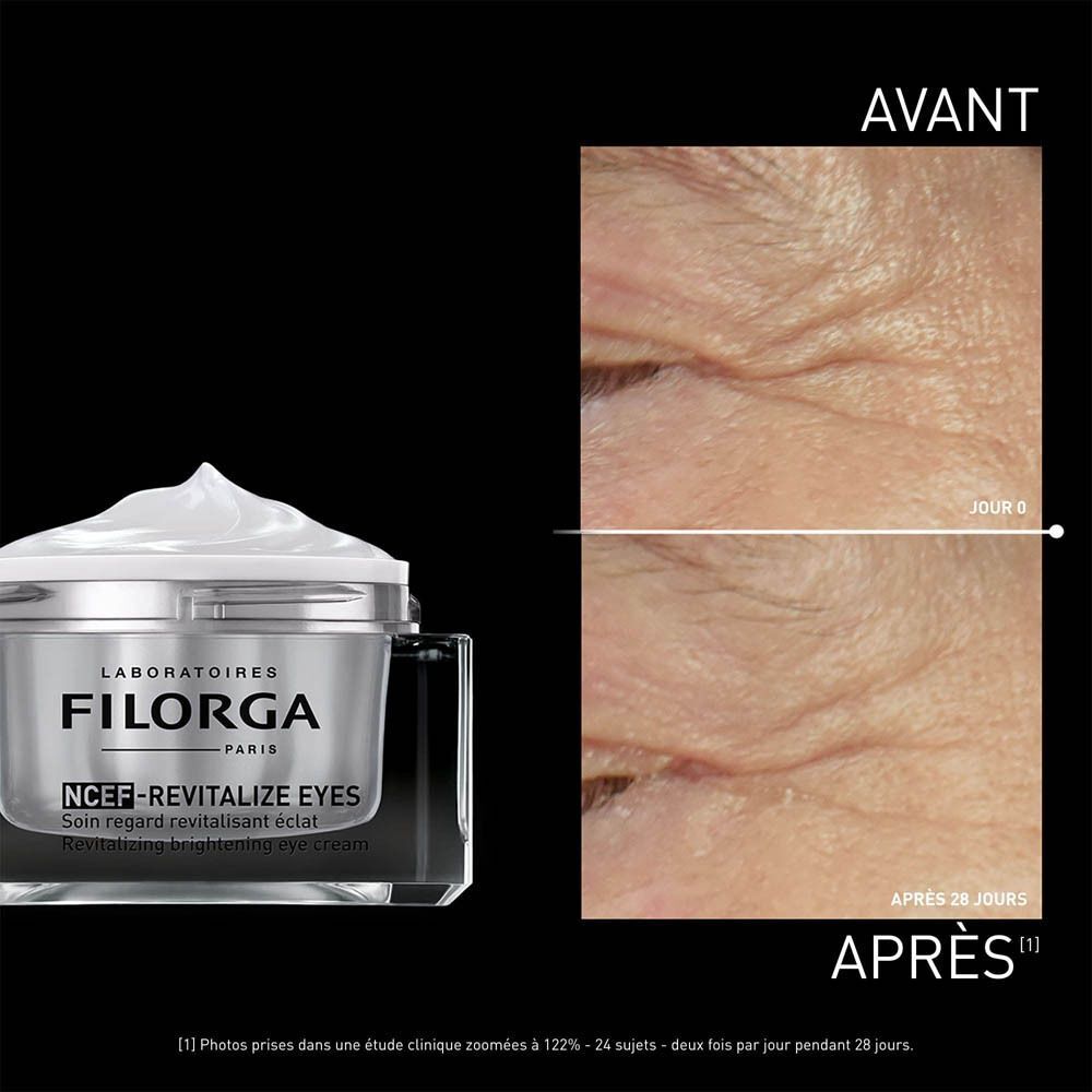 Comparaison avant-après de contours des yeux avec la crème Filorga NCEF-REVITALIZE EYES.