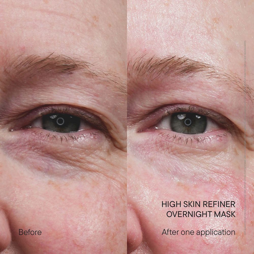 Comparaison avant-après de la peau après application du masque de nuit BABOR.