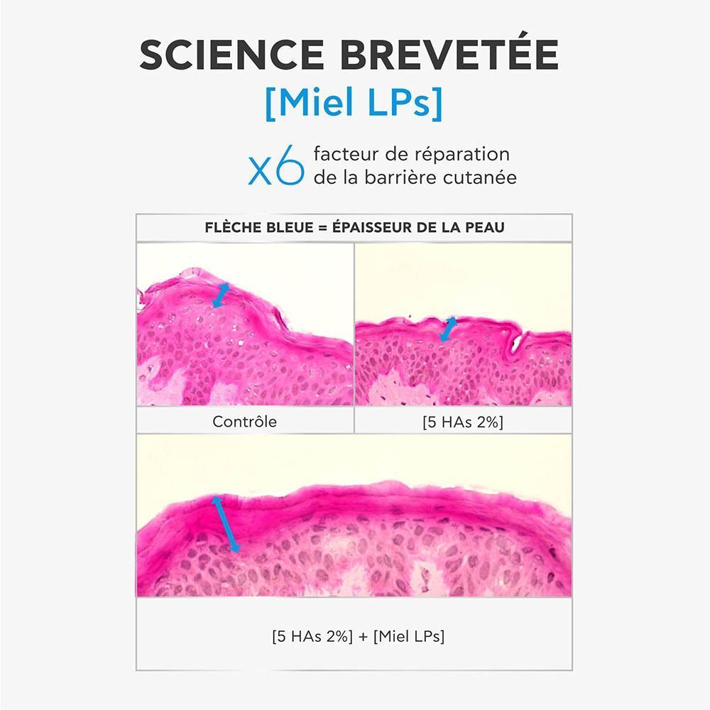 Images microscopiques de la peau montrant l'effet de l'acide hyaluronique et des LPs de miel.