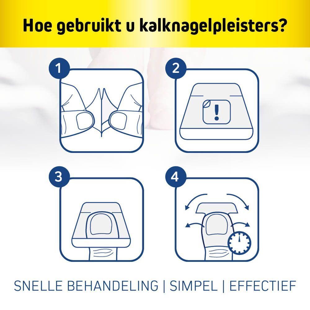 Vijf FungeX producten, waaronder pleisters voor nagelschimmel en een nagelreparateur.