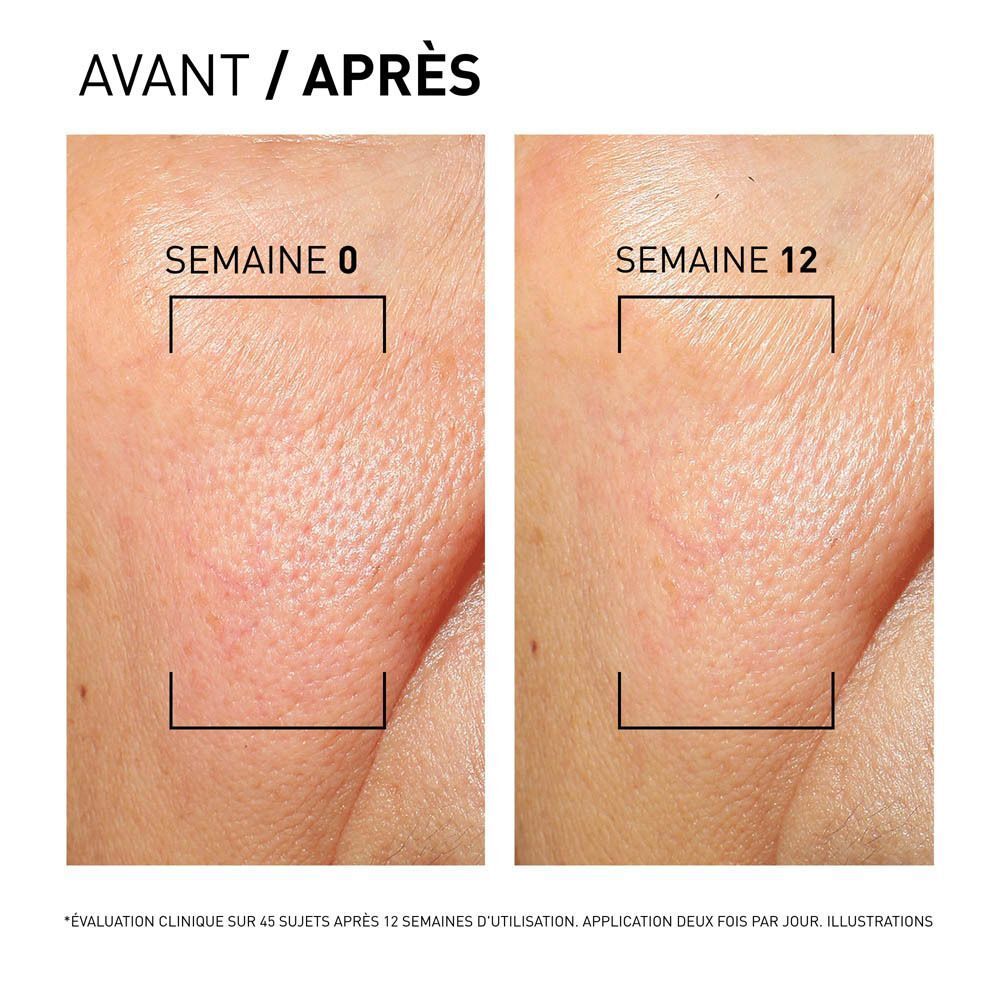 Comparaison avant/après de la texture de la peau après 12 semaines.