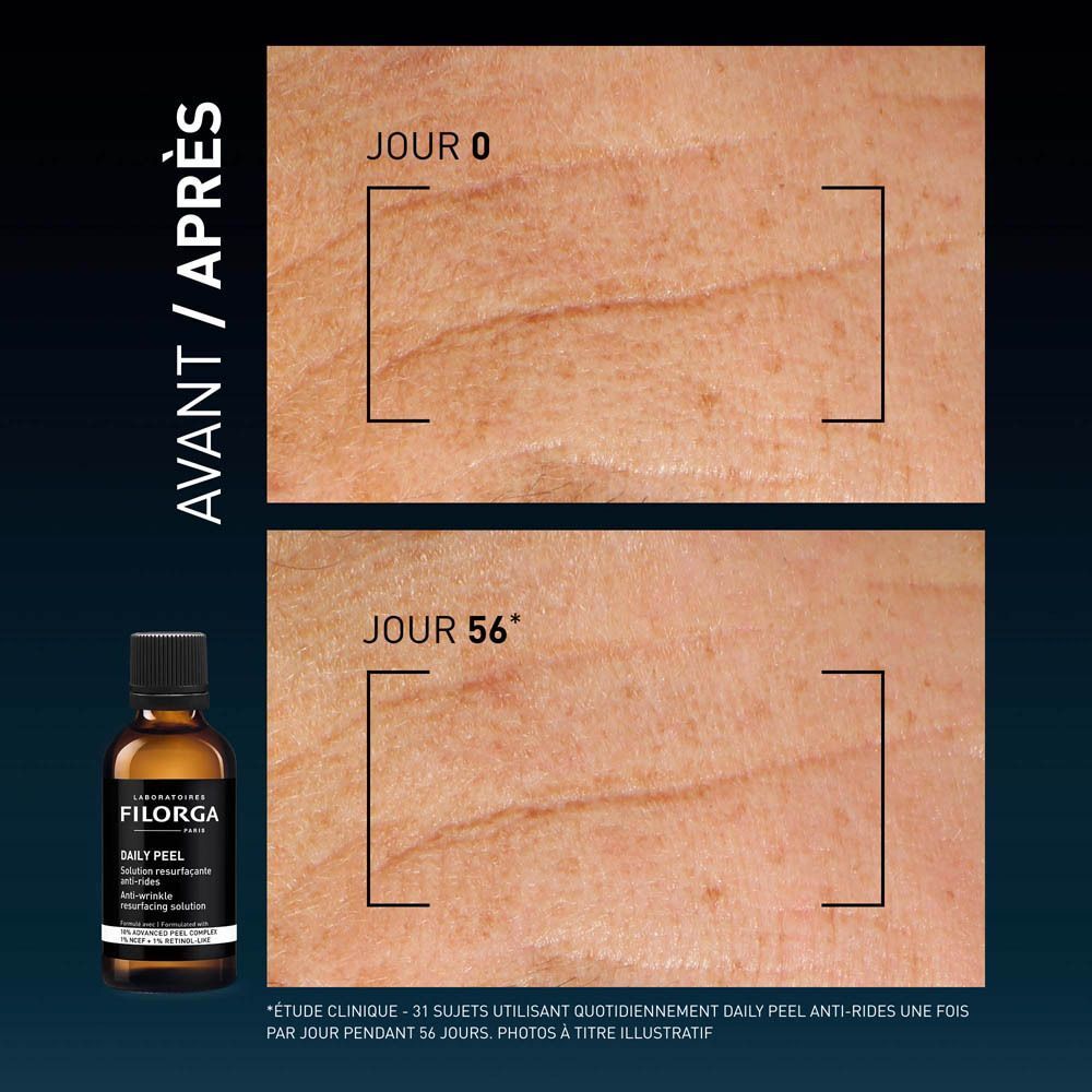 Comparaison avant/après de peau ridée, flacon Filorga.