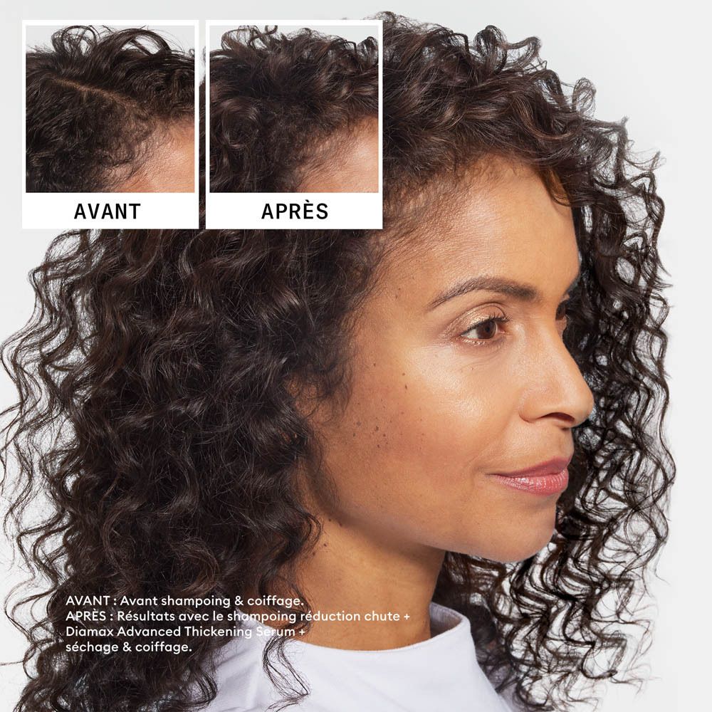 Comparaison avant/après de la densité des cheveux. Gauche : avant. Droite : après avec le sérum épaississant Diamax.