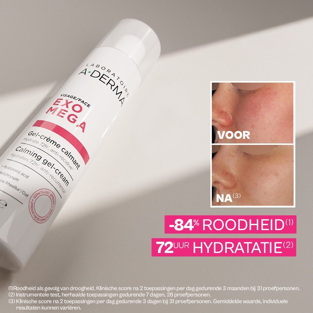 A-Derma Exomega Gel-crème: Gezichtsvoor-en-na-vergelijking, toont -84% roodheid en 72u hydratatie.