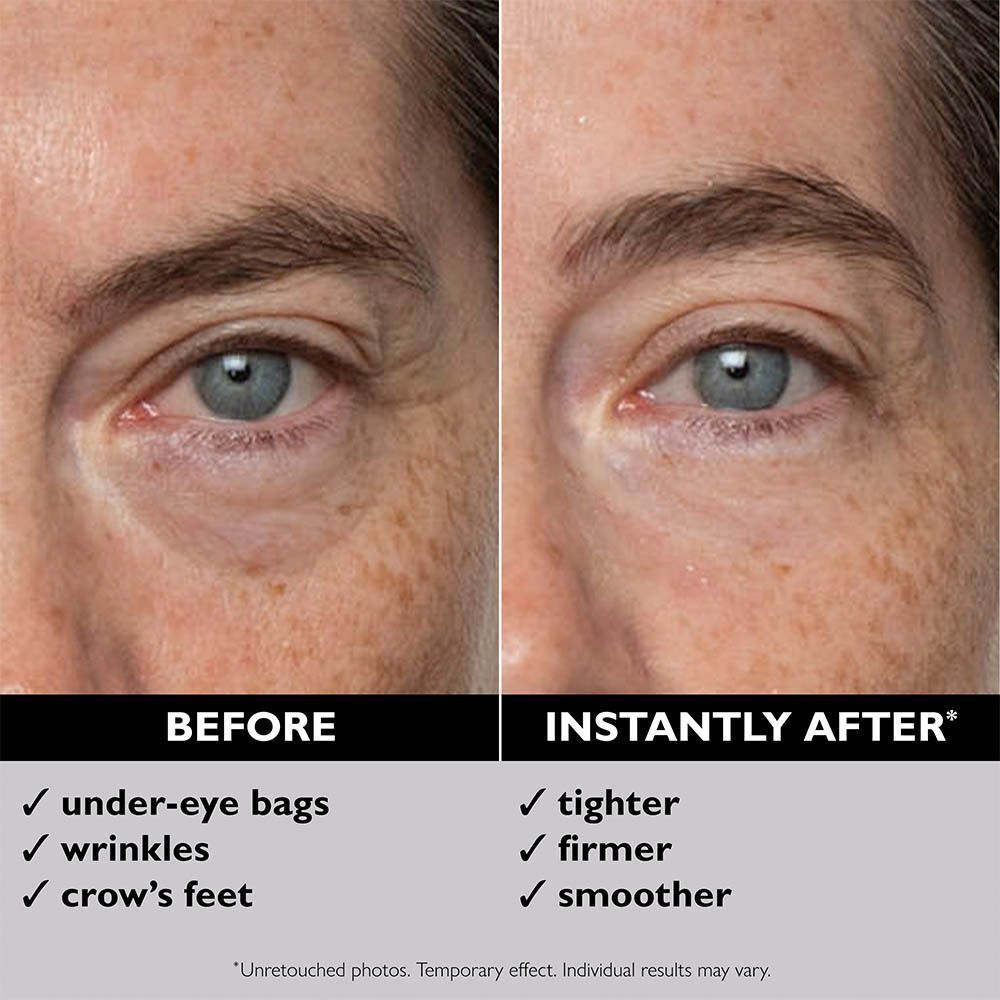 Comparaison du contour des yeux avant et après l'application de Peter Thomas Roth Instant FirmX Eye.