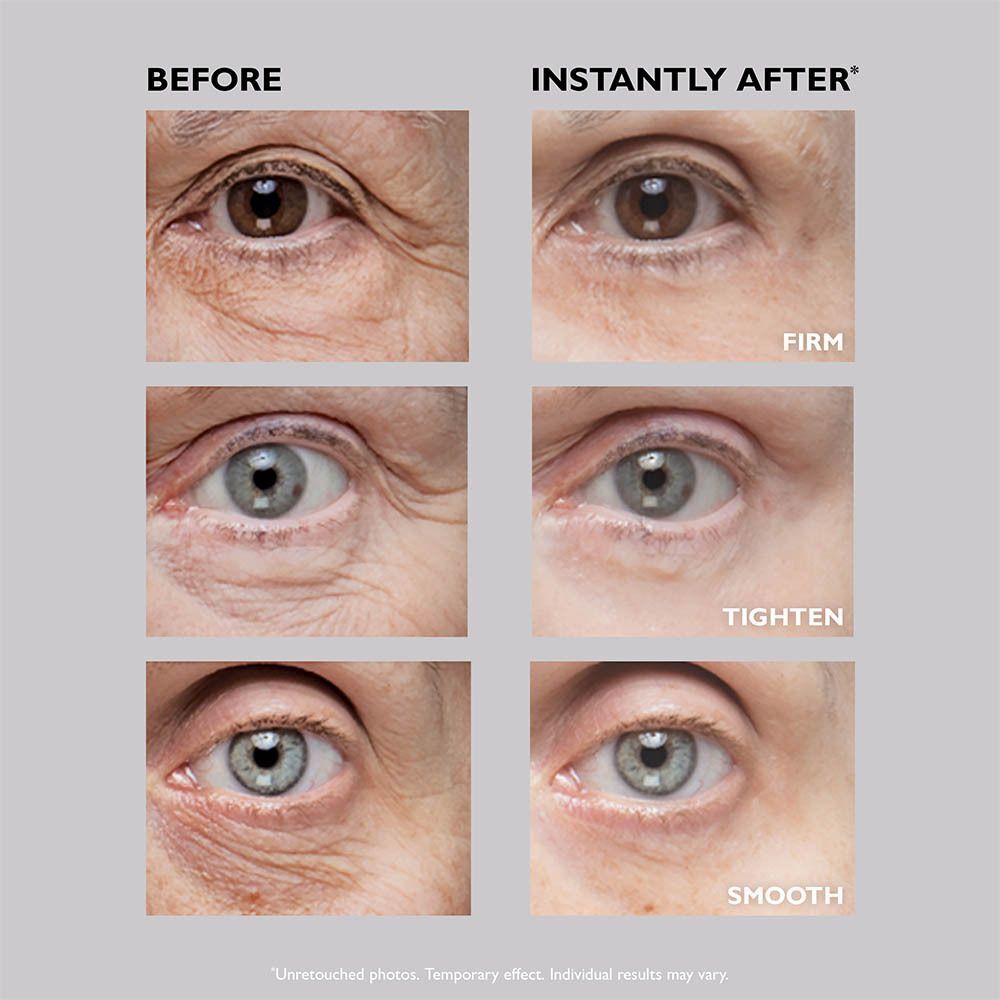 Drie oogcontouren vergeleken: voor en na gebruik van Peter Thomas Roth Instant FirmX Eye.