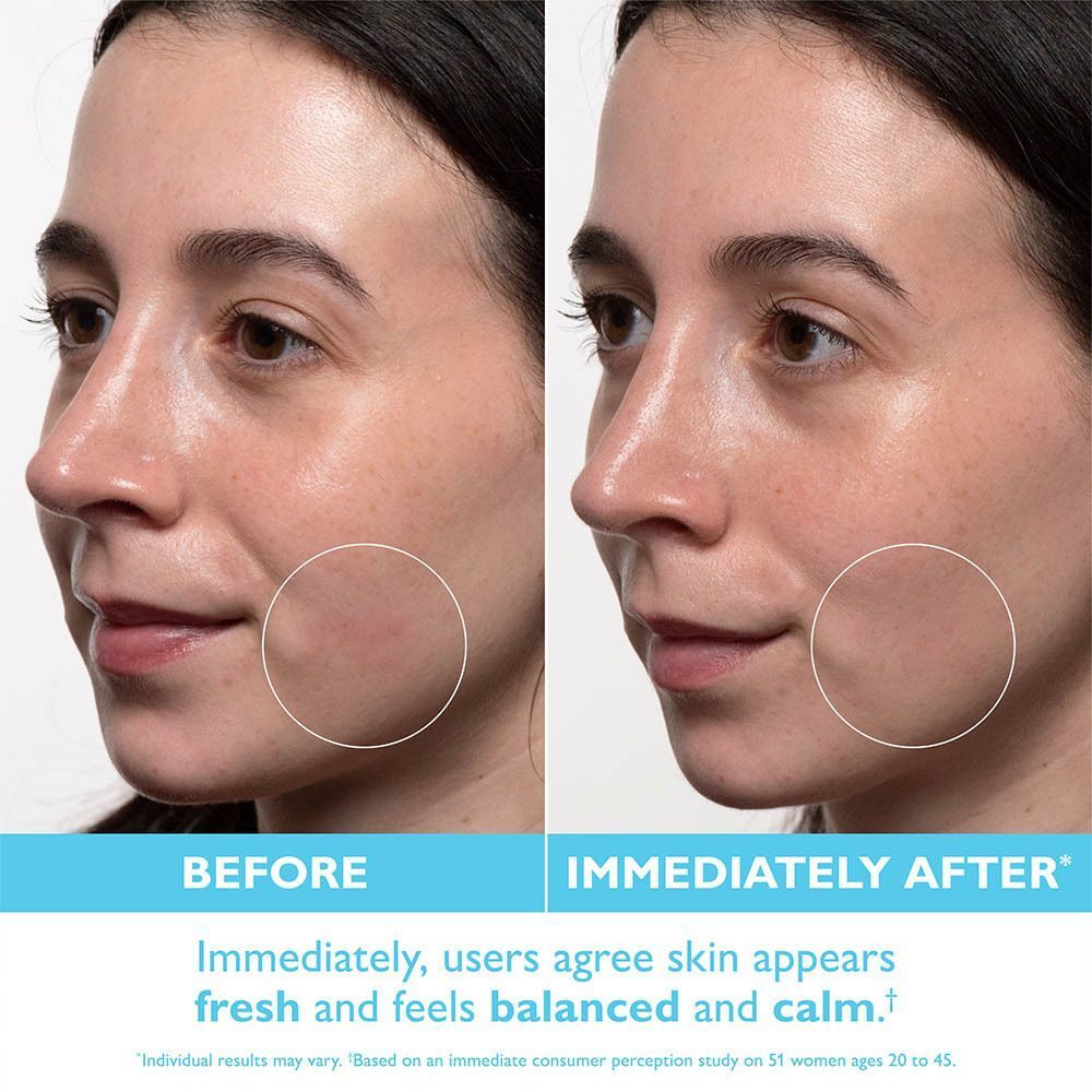 Comparaison avant/après d'une femme utilisant le Peter Thomas Roth Water Drench Hyaluronic Jelly Moisturizer.