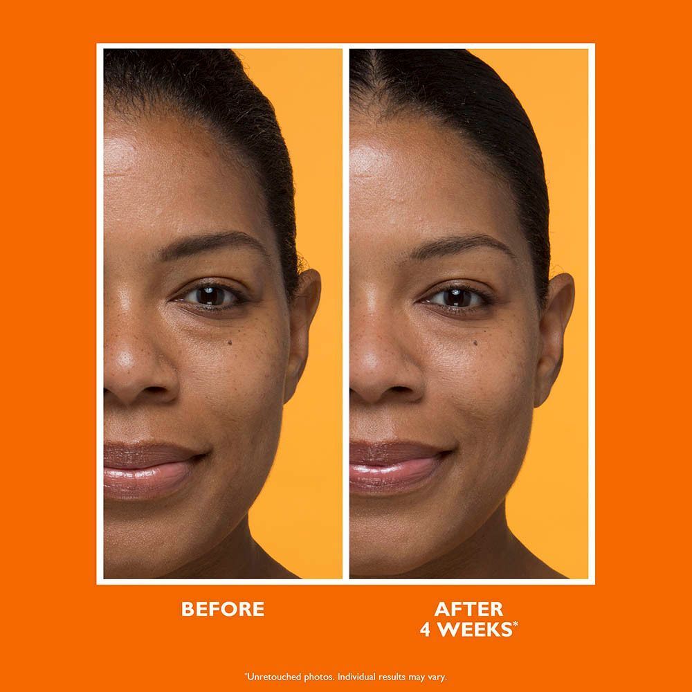 Comparaison avant-après d'une femme utilisant Peter Thomas Roth Potent C Brightening Vitamin C Moisturizer.