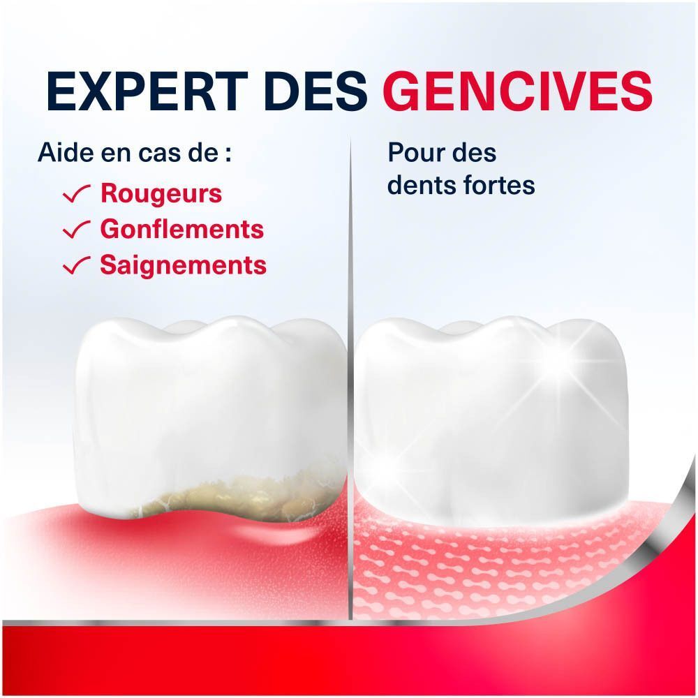Comparaison de dents : à gauche avec gencive enflammée, à droite saine et forte.
