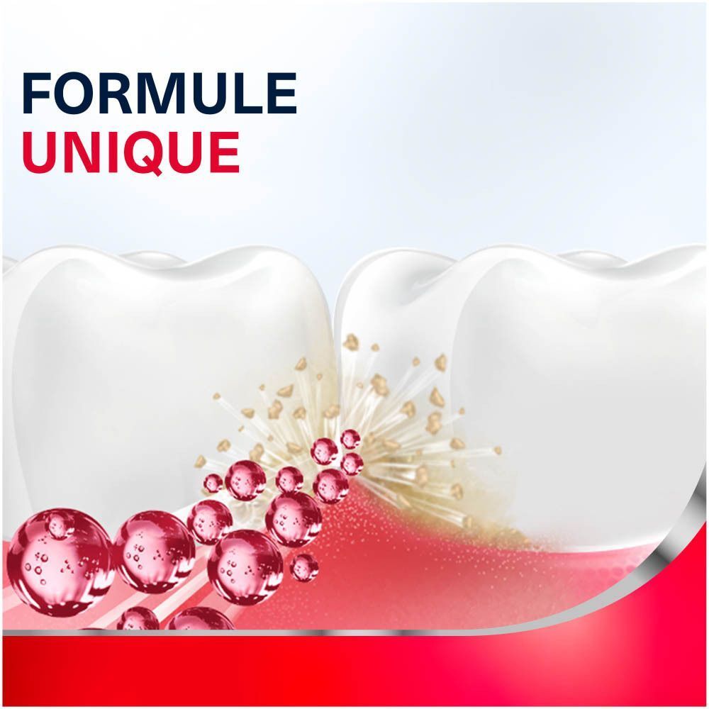 Deux dents blanches avec des bulles rouges et des particules entre elles.