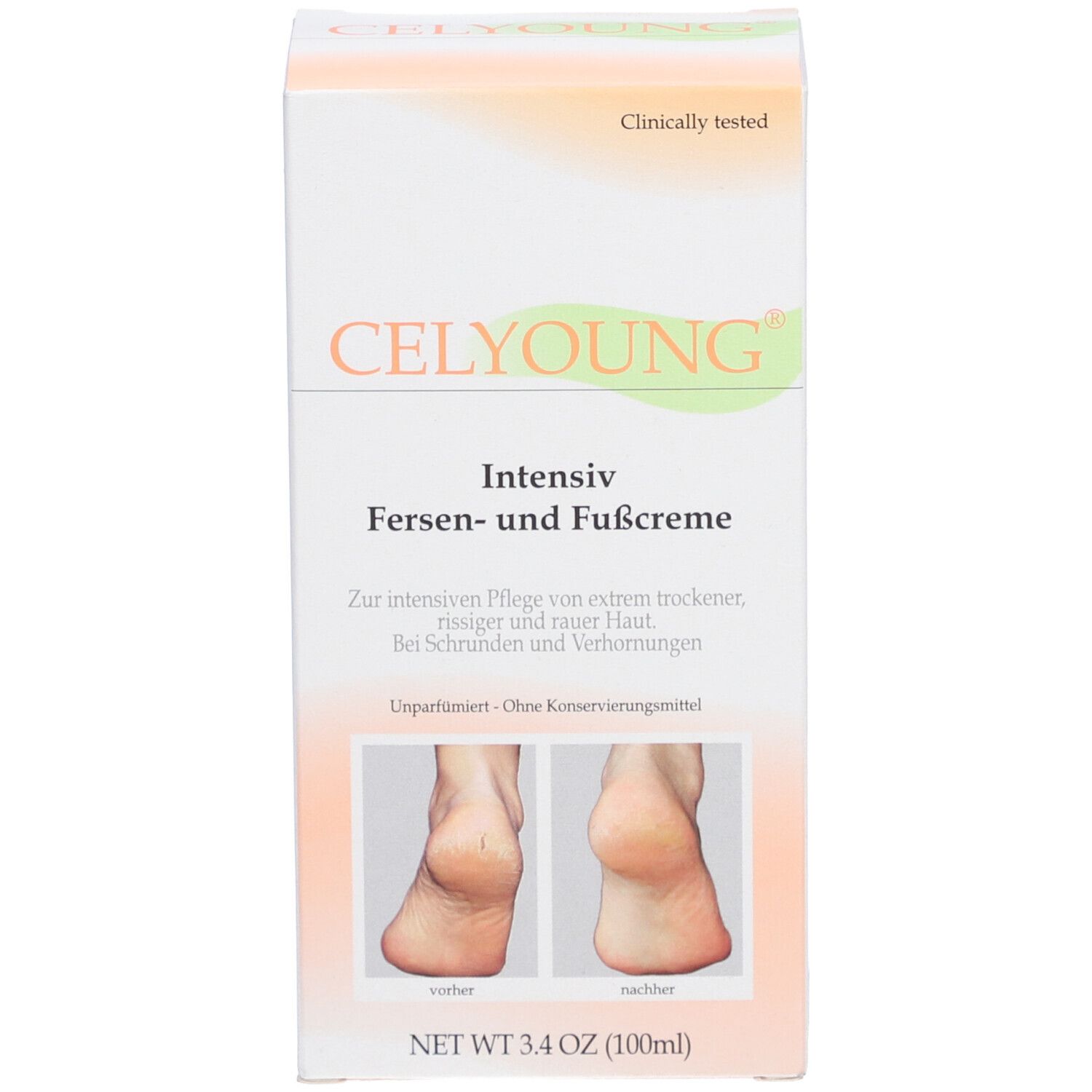 Celyoung Intensiv crème verpakking. Doos met productnaam en afbeeldingen van voeten.